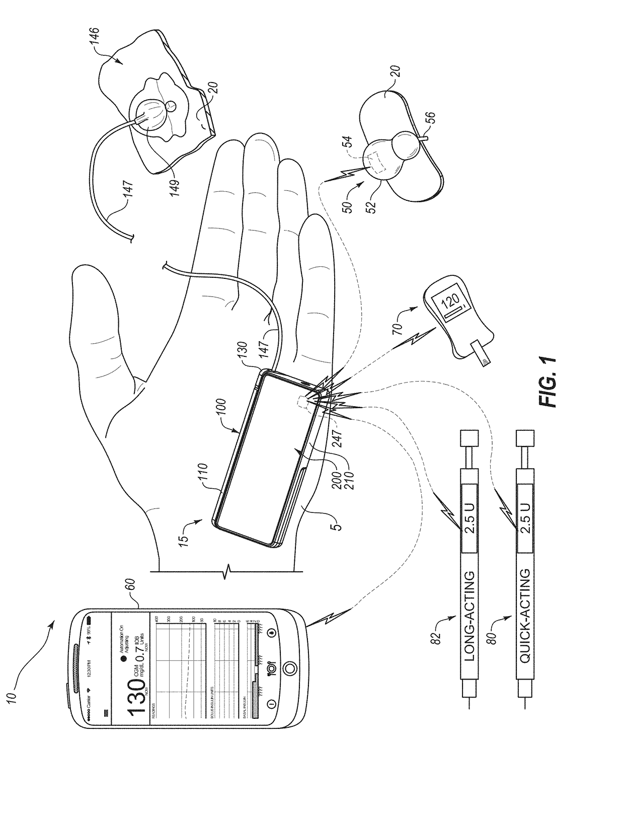 System and method for adjusting insulin delivery