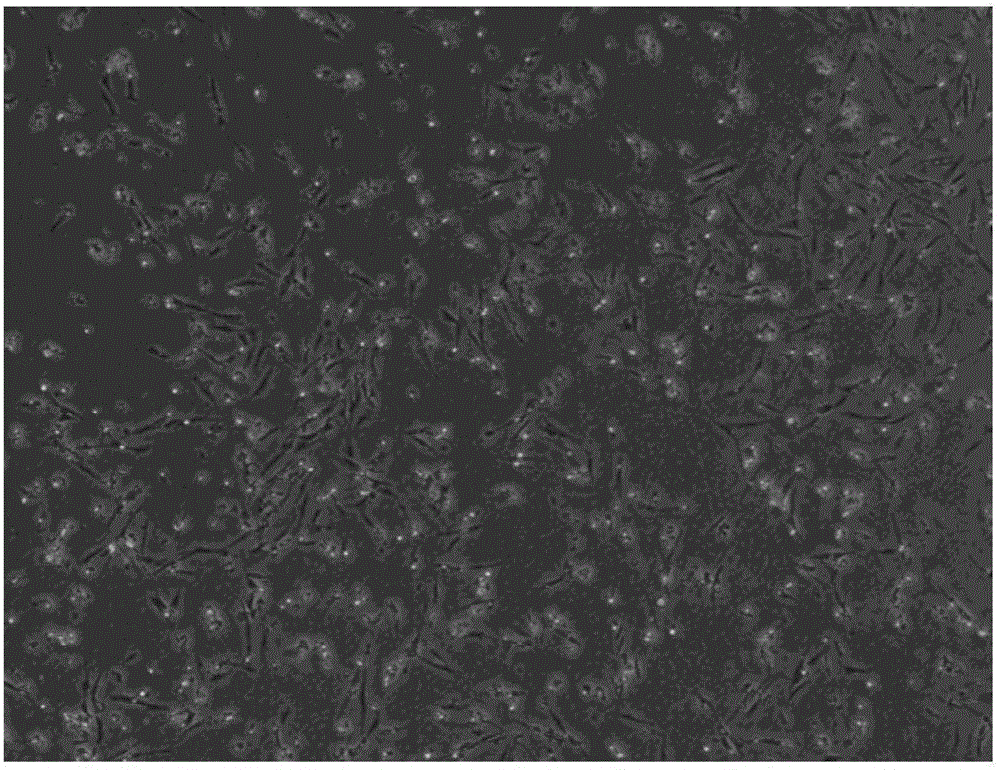 Method for efficient transfection of turbot muscle cells