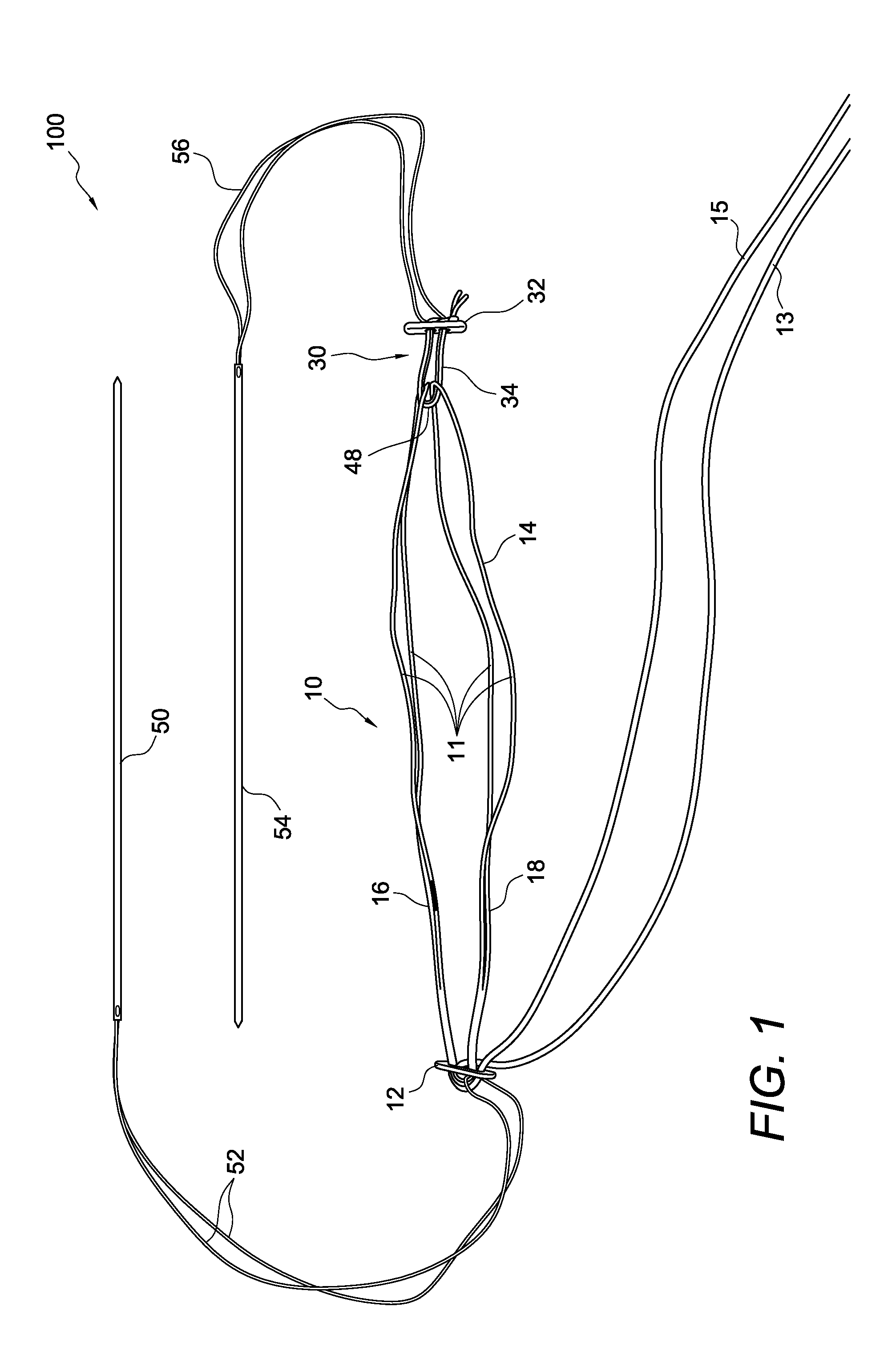 Adjustable suture-button construct for knotless stabilization of cranial cruciate deficient ligament stifle