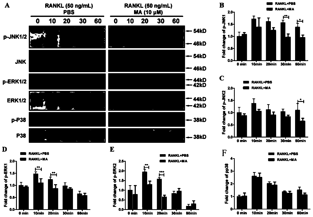 Application of signal pathway signal inhibitor or protein synthesis inhibitor or madecassic acid in preparation of drug for treating osteoporosis