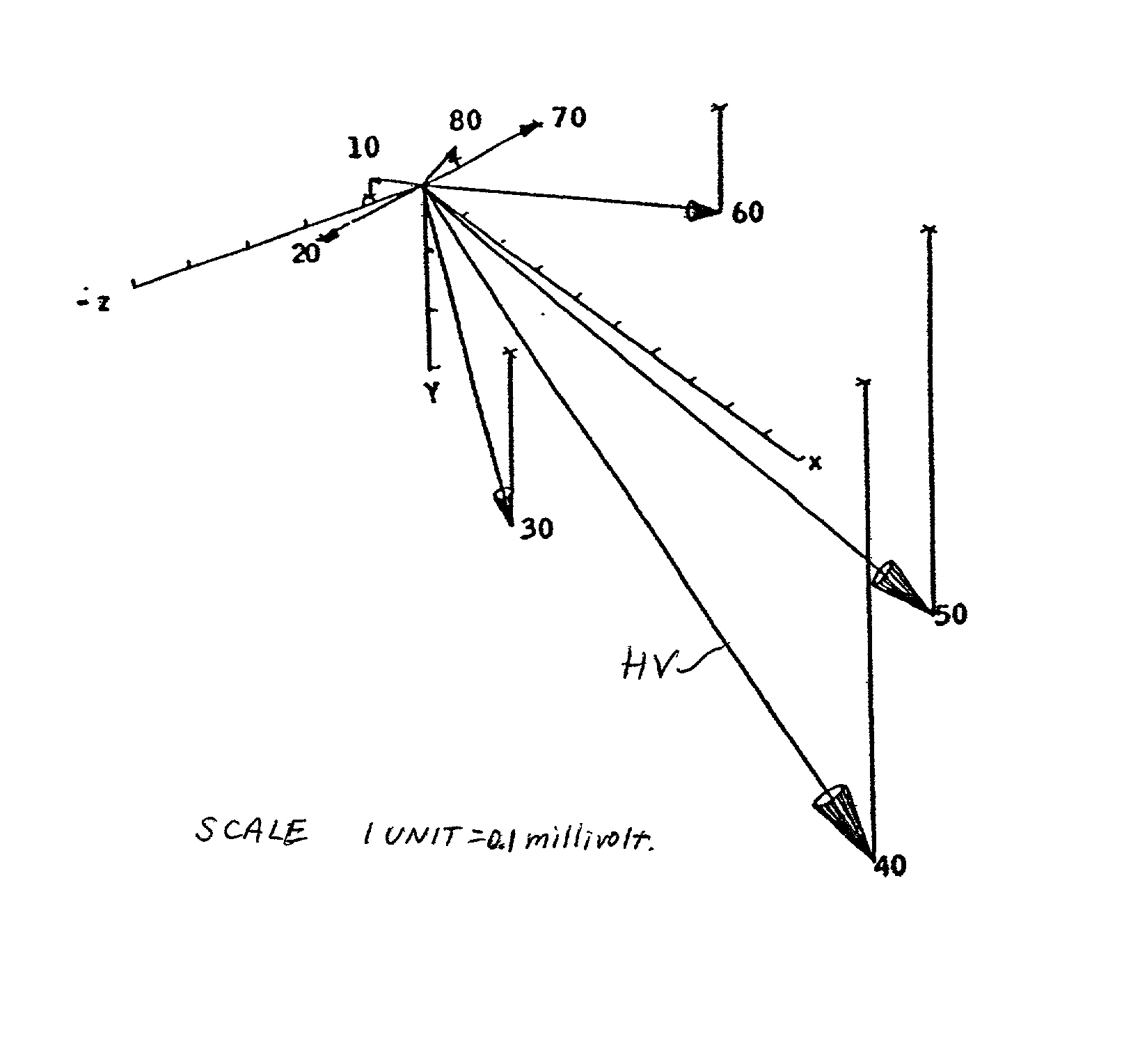 Method of analysis of the electrocardiogram