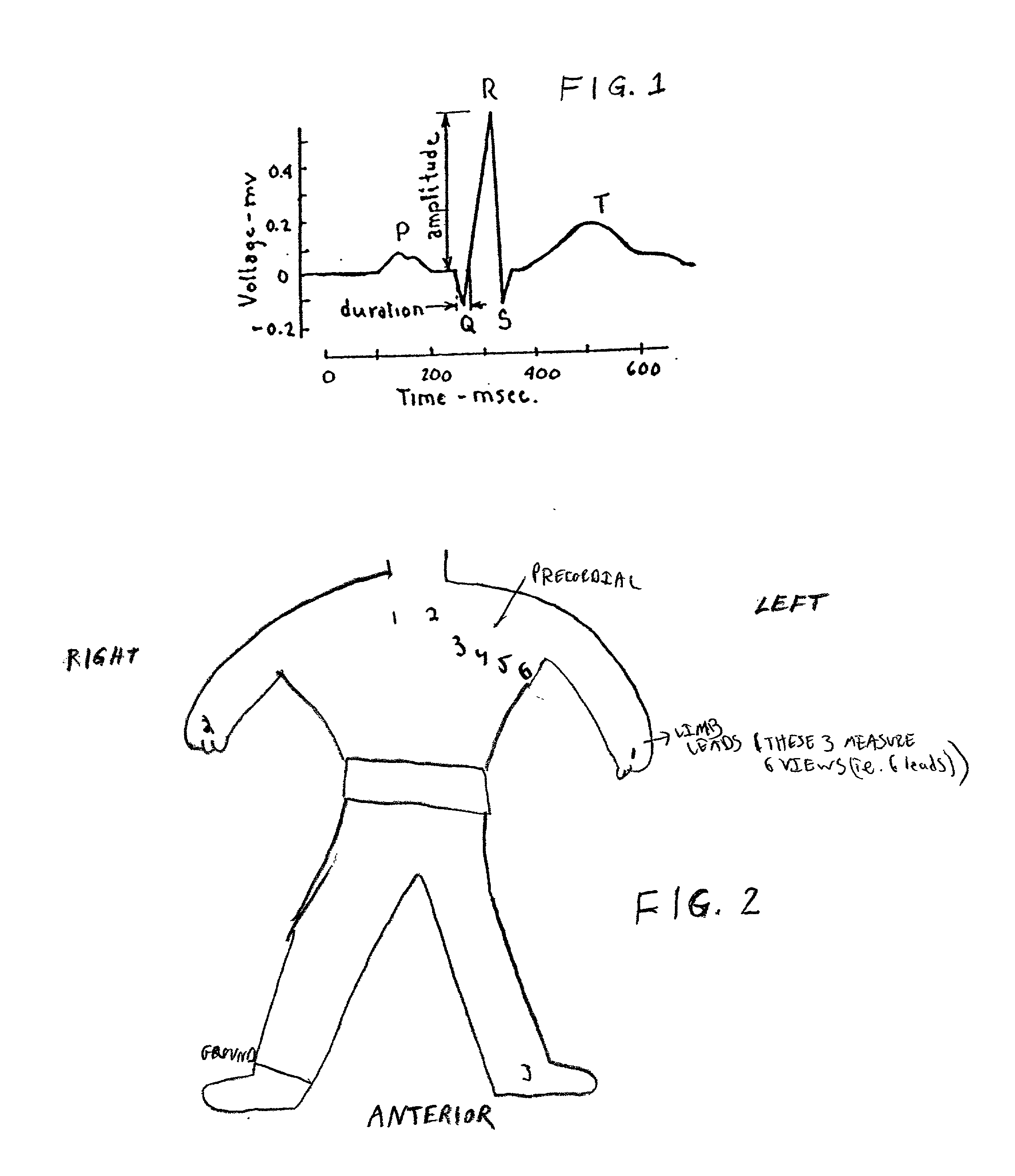 Method of analysis of the electrocardiogram