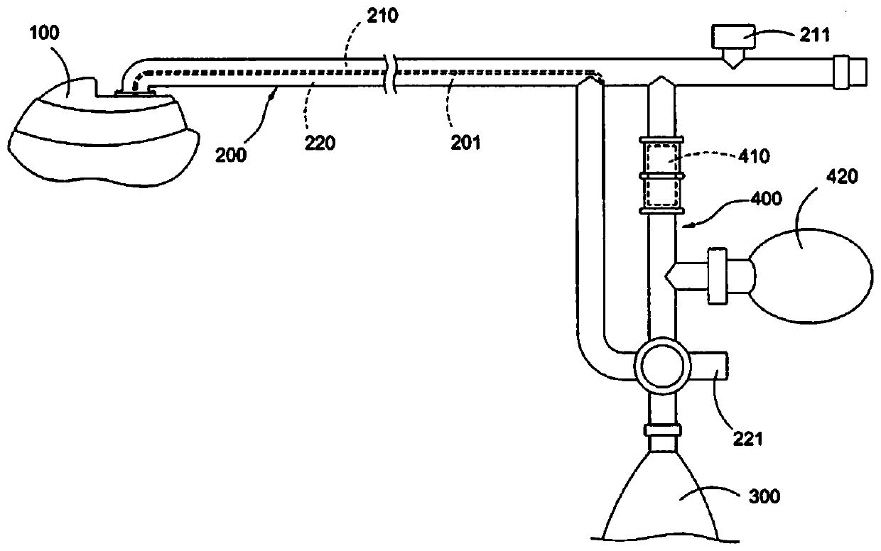 Suction-type anesthesia device for children