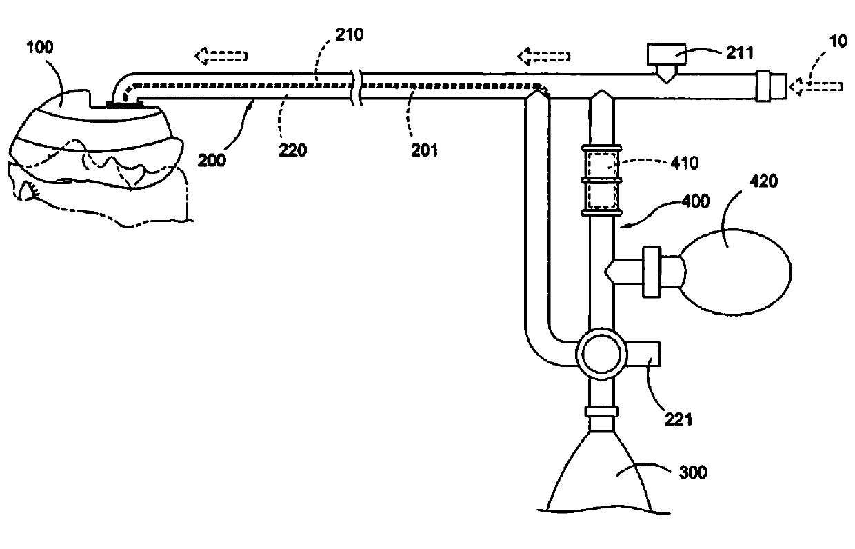 Suction-type anesthesia device for children