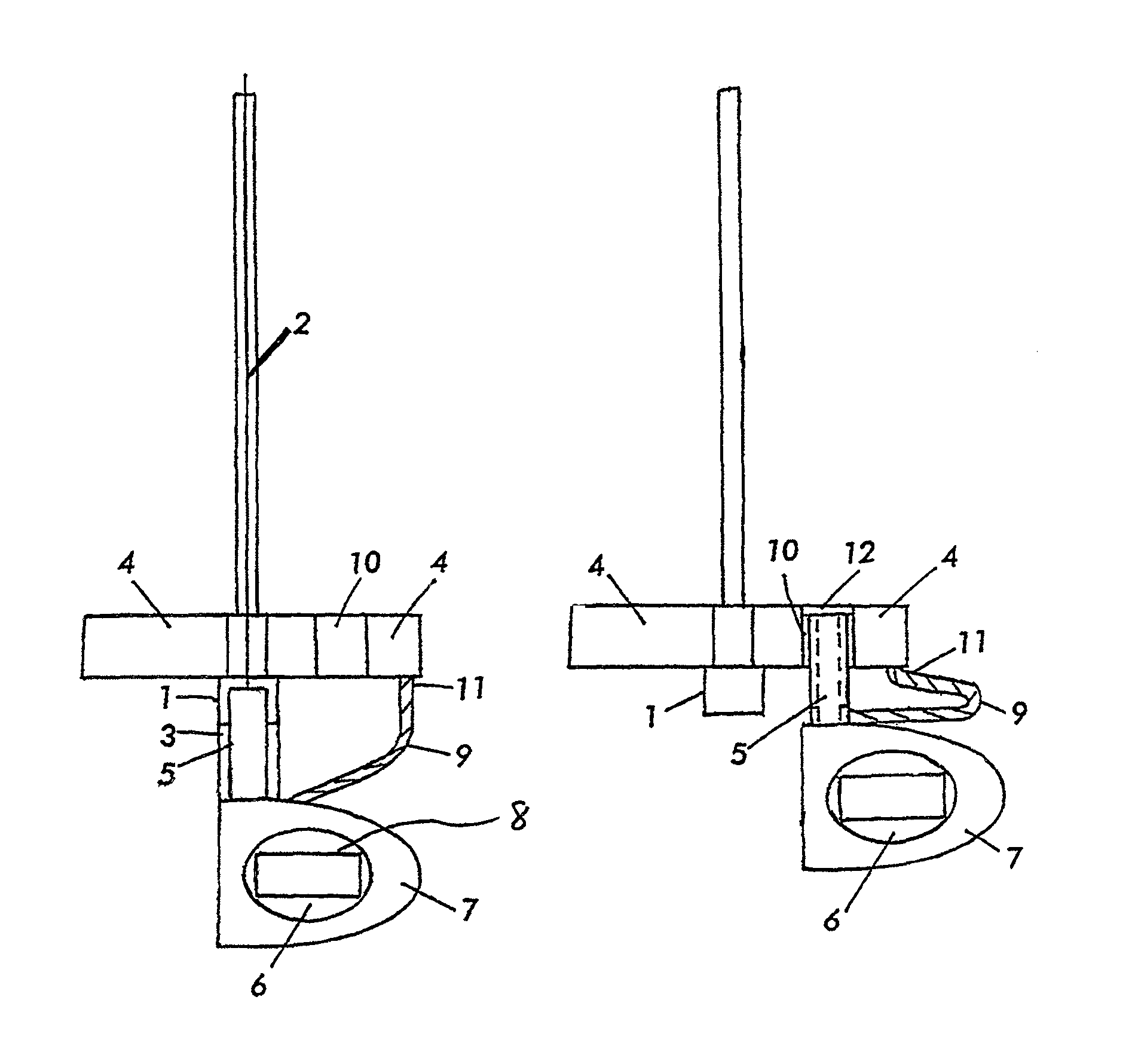 Intravenous indwelling catheter