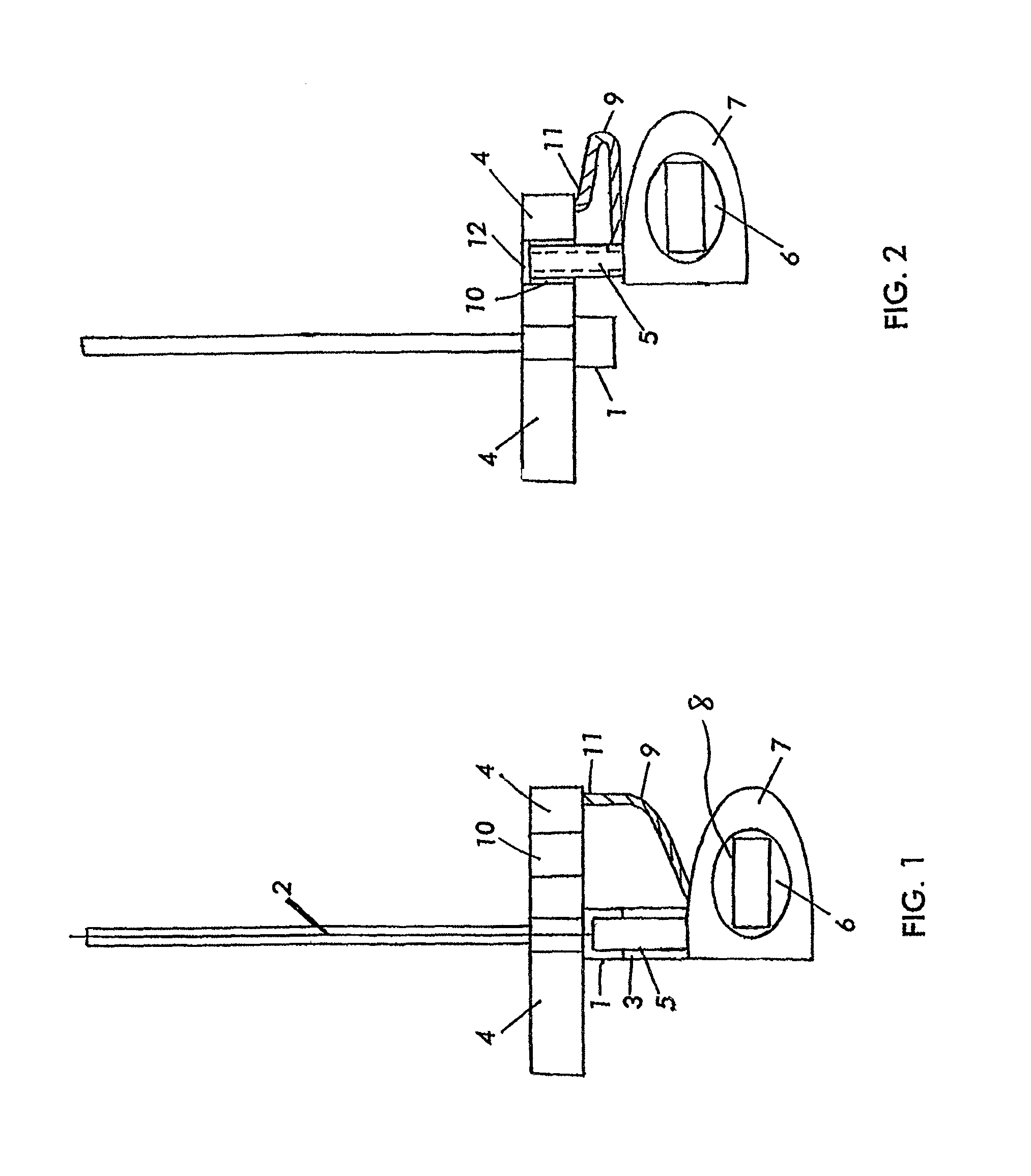 Intravenous indwelling catheter