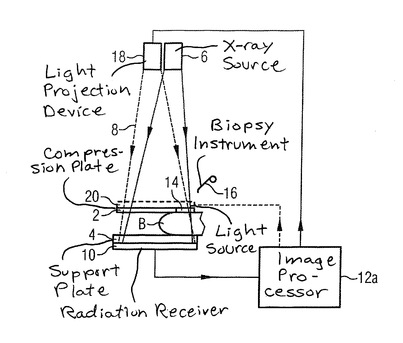 Method for positioning the breast for a biopsy in a mammography device, and mammography device to implement the method