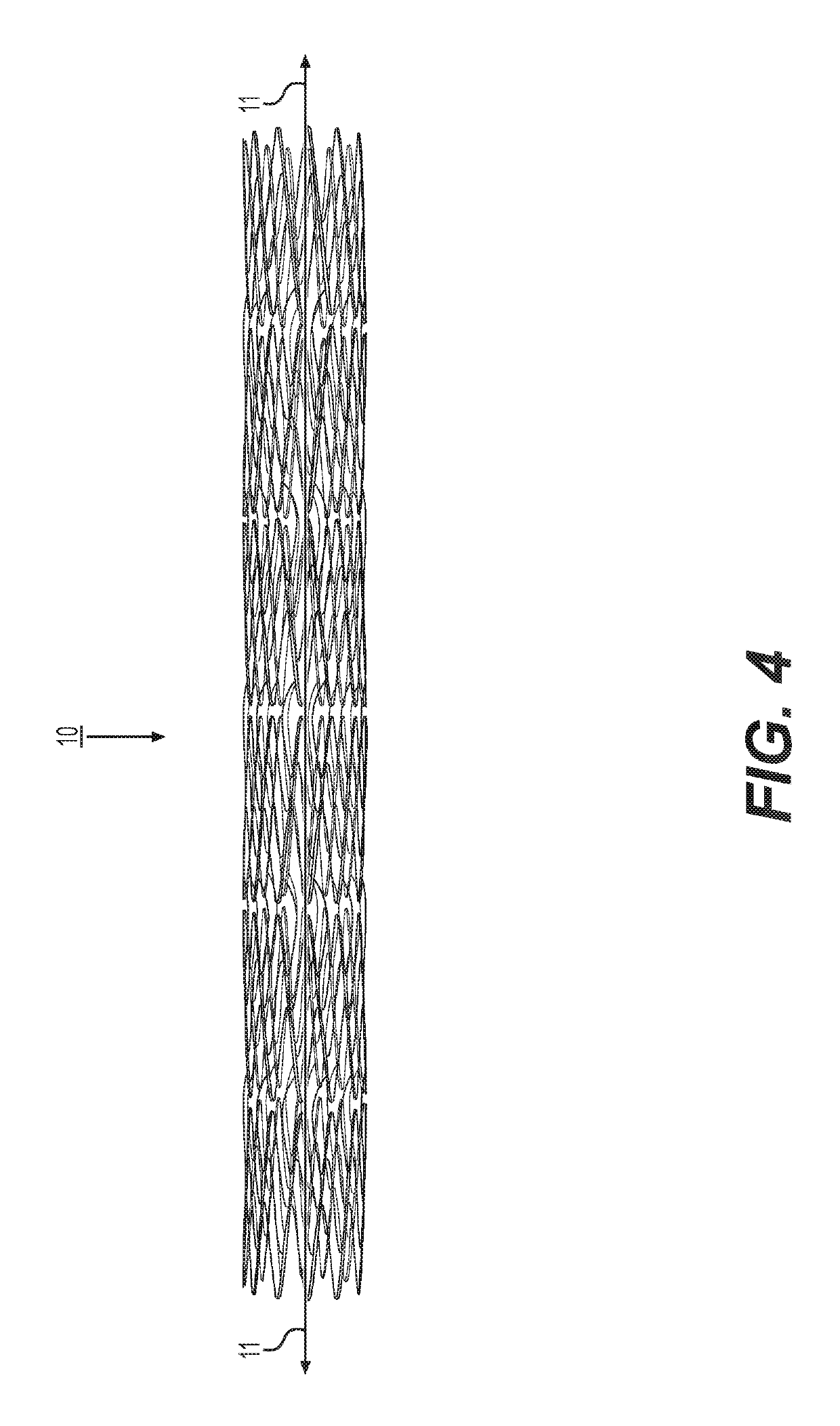 Implantable stent