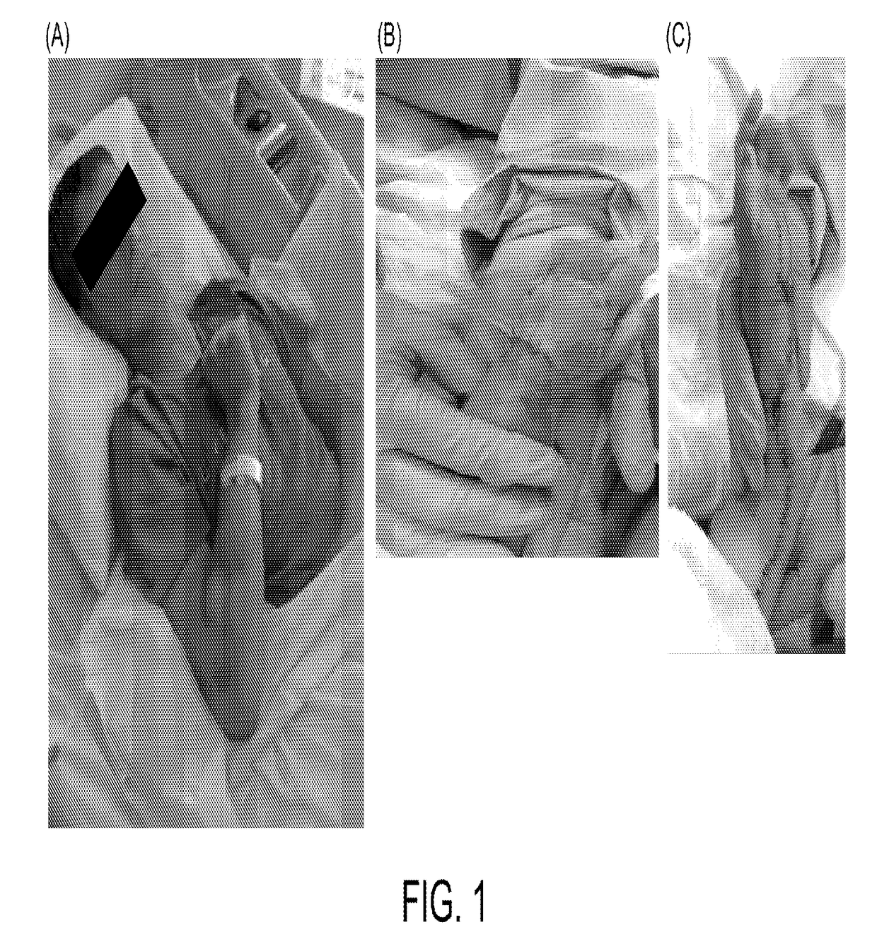 Intravenous access device detecting intravenous infiltration and in-vein placement