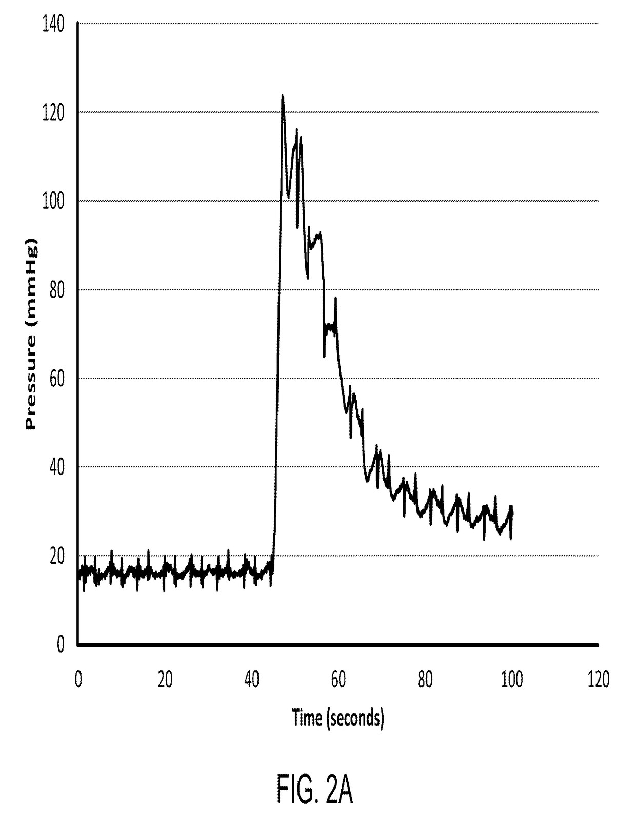 Intravenous access device detecting intravenous infiltration and in-vein placement