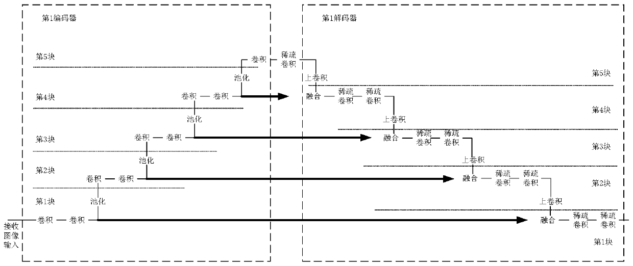 Image recognition method, system and device for liver and gall vessels and calculus and storage medium