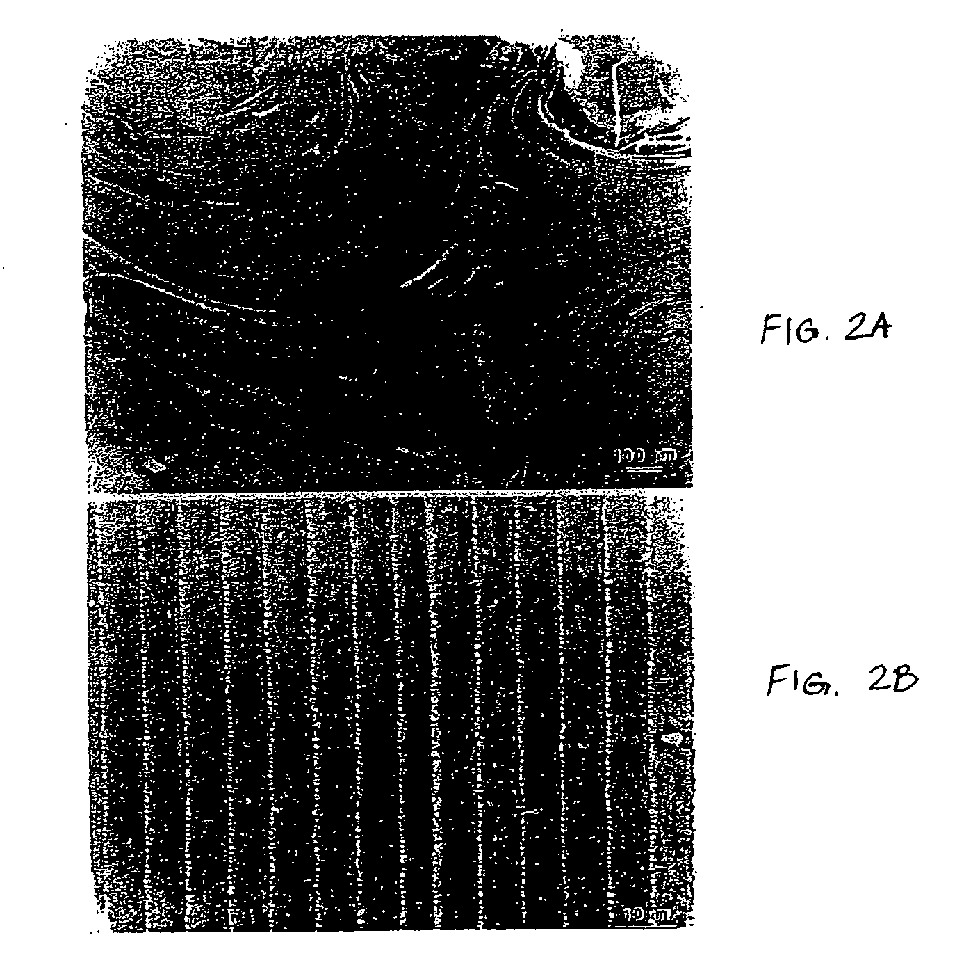 Hyaluronic acid in the enhancement of lens regeneration