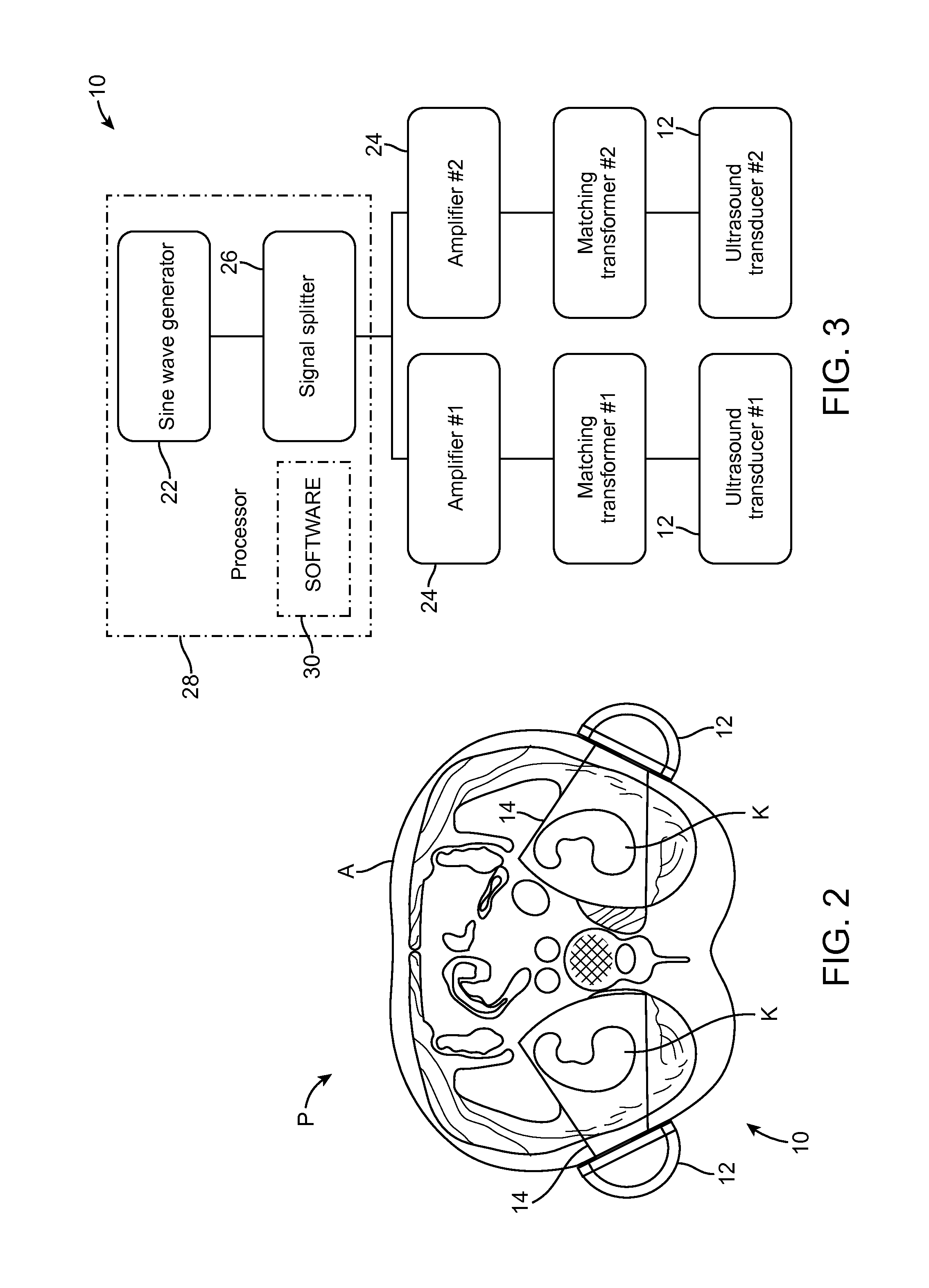 Renal Injury Inhibiting Devices, Systems, and Methods Employing Low-Frequency Ultrasound or Other Cyclical Pressure Energies