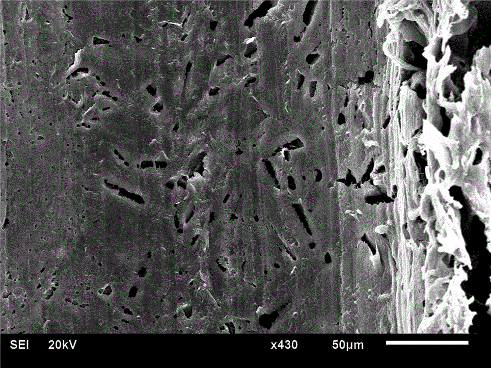 Preparation method of bone repair scaffold with osteoid porous regenerative channel structure