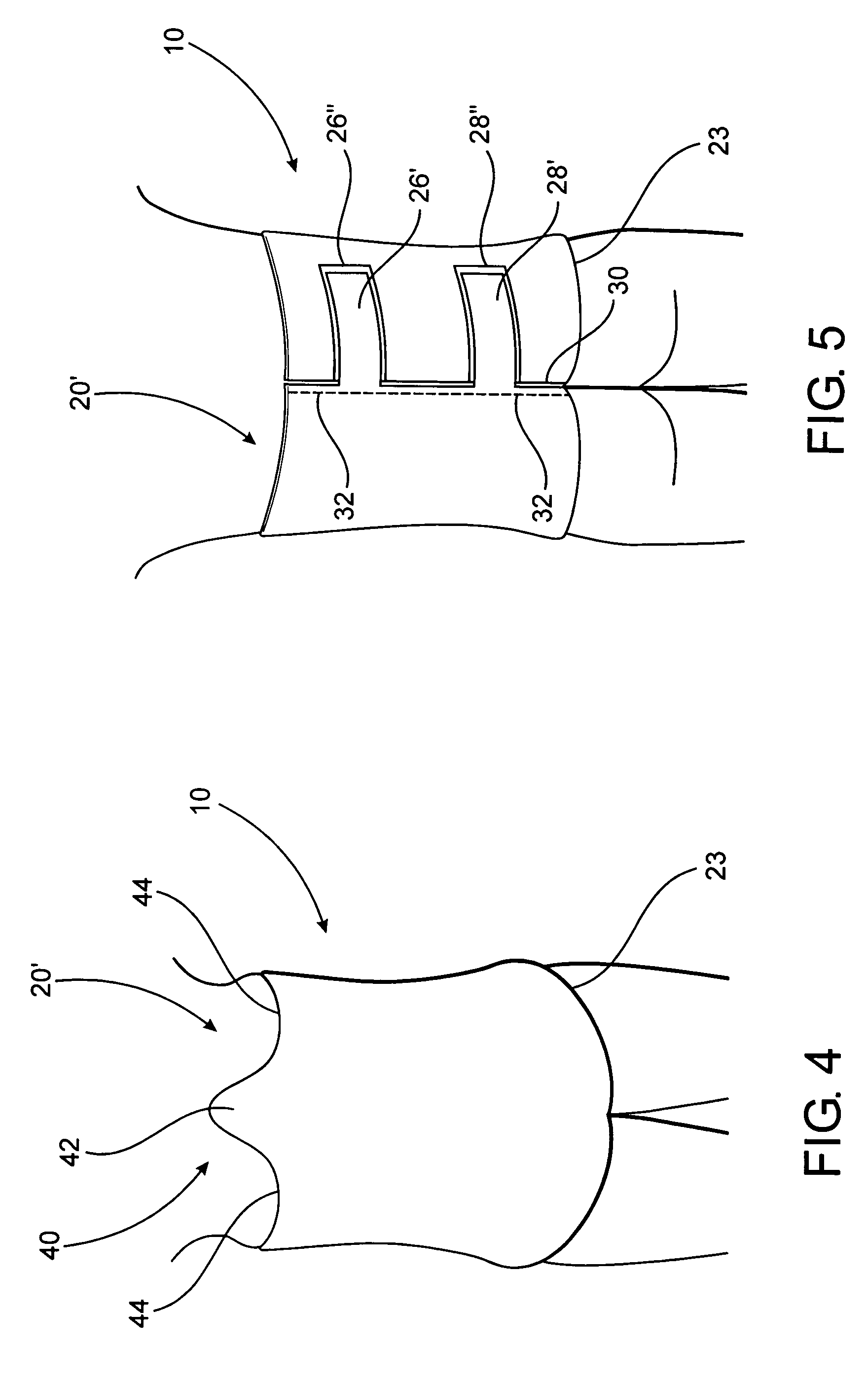 Post operative pressure garment