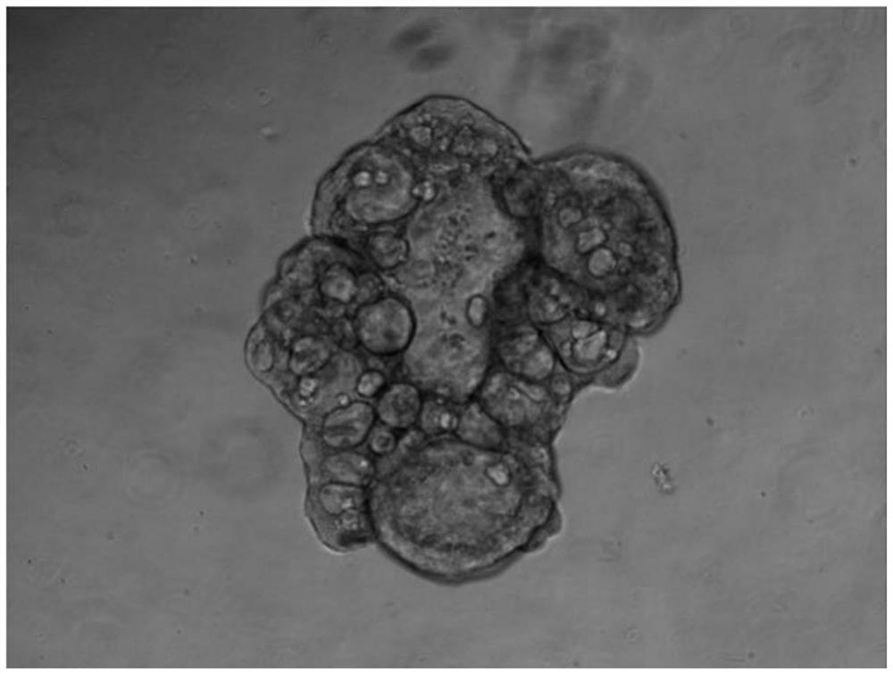 Thyroid organoid culture medium and thyroid organoid culture and passage method