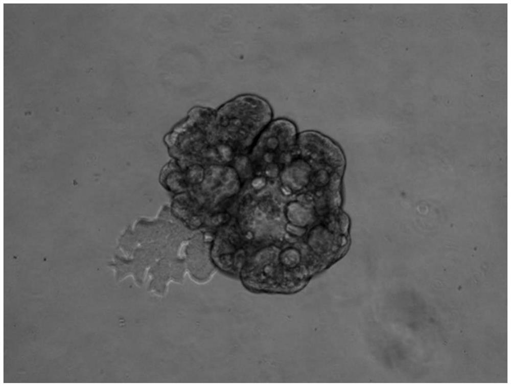 Thyroid organoid culture medium and thyroid organoid culture and passage method