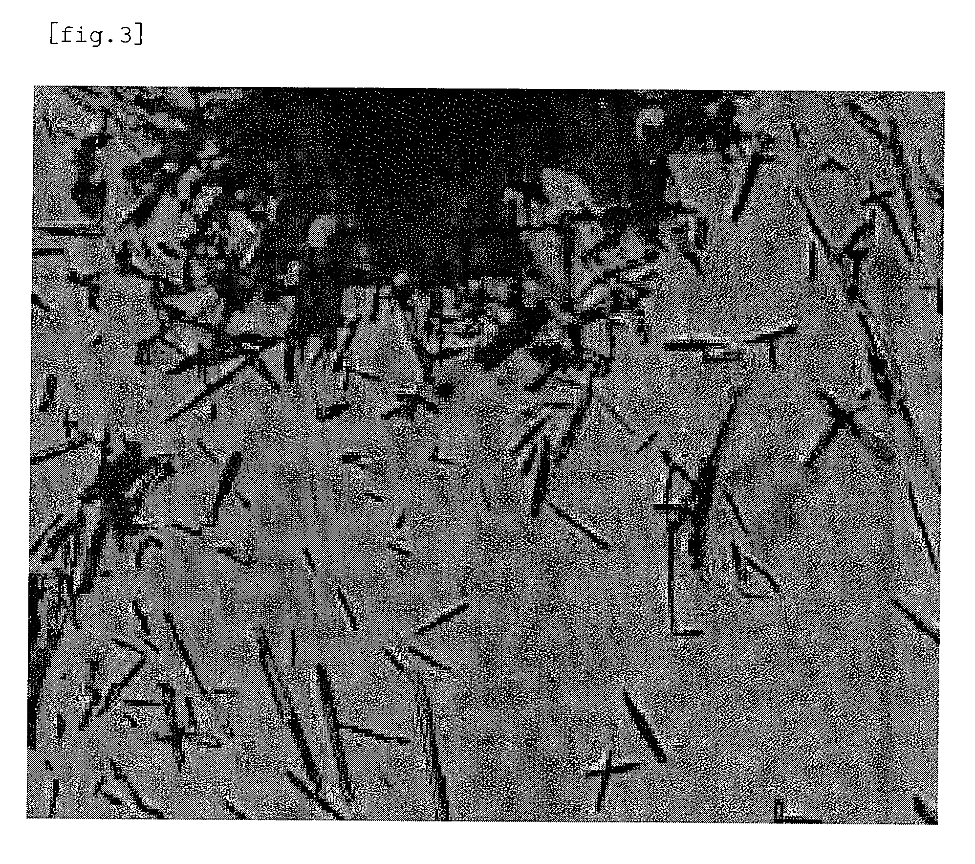 Pharmaceutical composition for external use