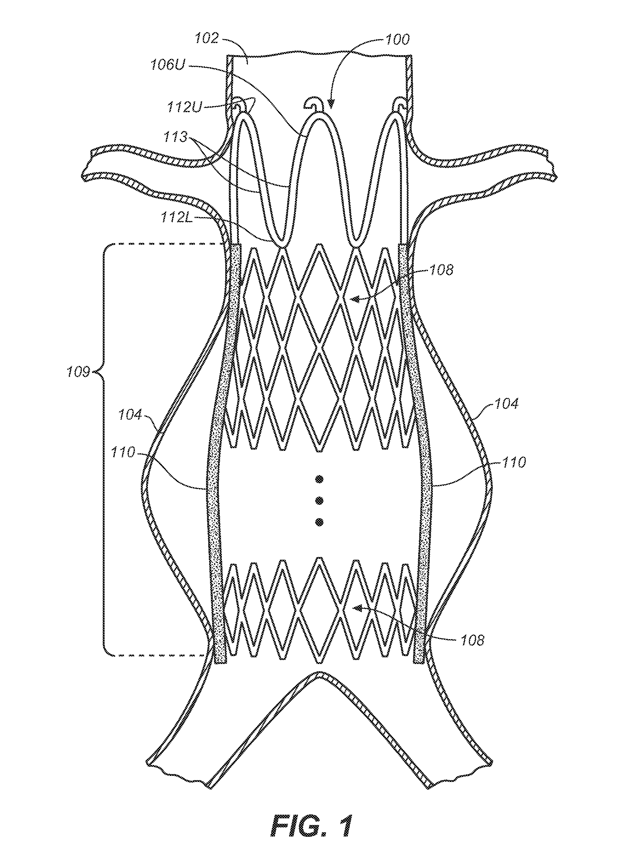 Self-flaring active fixation element for a stent graft