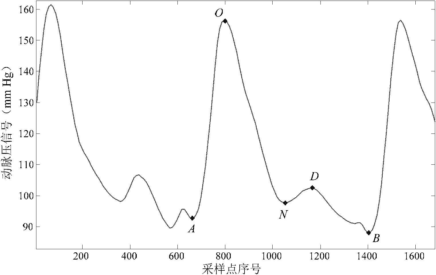 Method for identifying dicrotic notch point in arterial tension signal