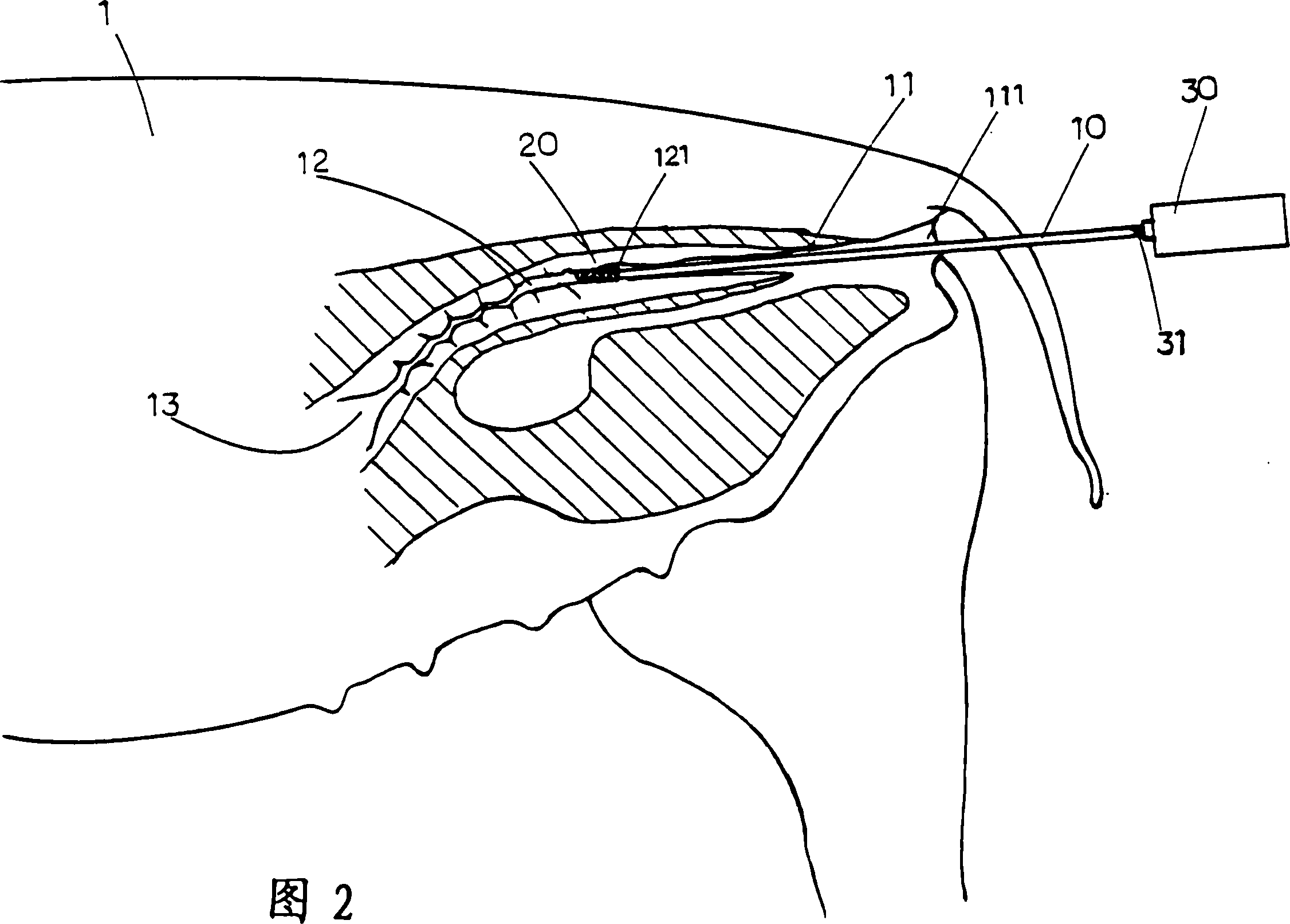 Artificial trace insemination device for animal