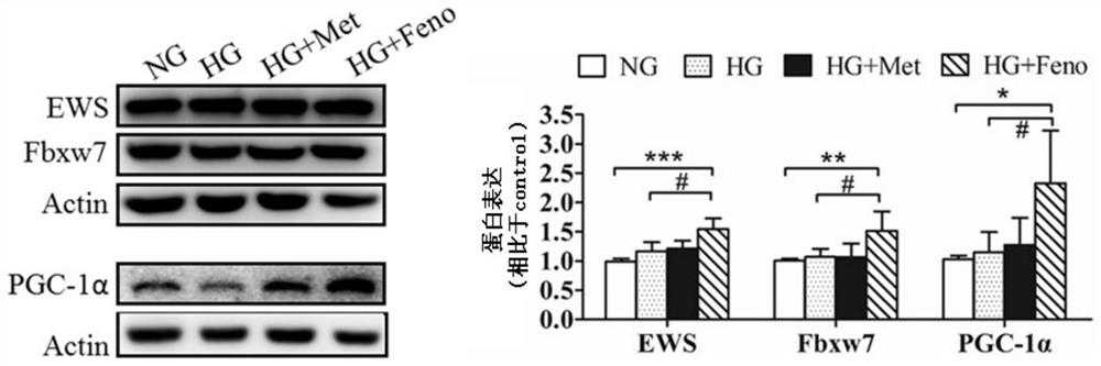 Application of fbxw7 or its upregulator in the preparation of medicines for treating diabetes and preventing and treating tumors in diabetic individuals