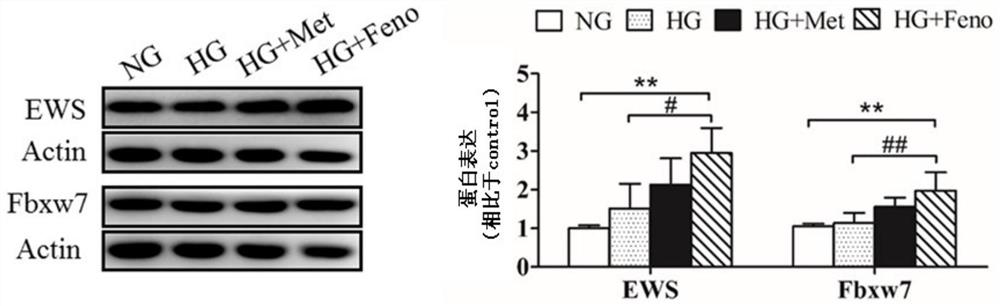 Application of fbxw7 or its upregulator in the preparation of medicines for treating diabetes and preventing and treating tumors in diabetic individuals