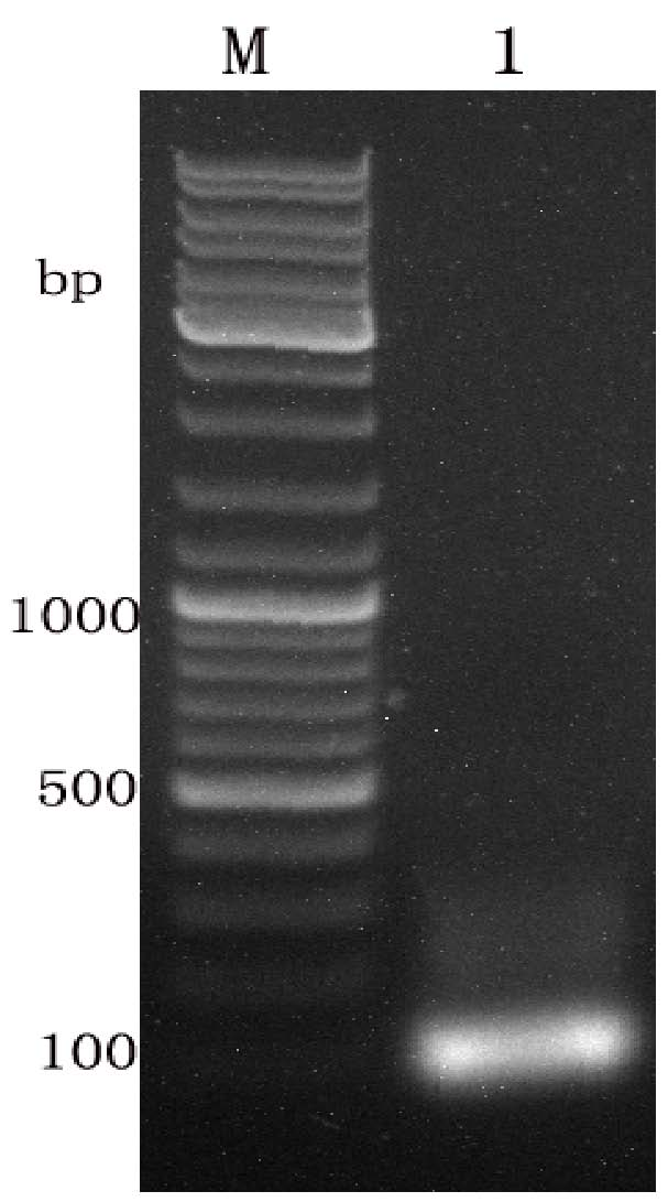 Malaria vaccine and preparation method thereof