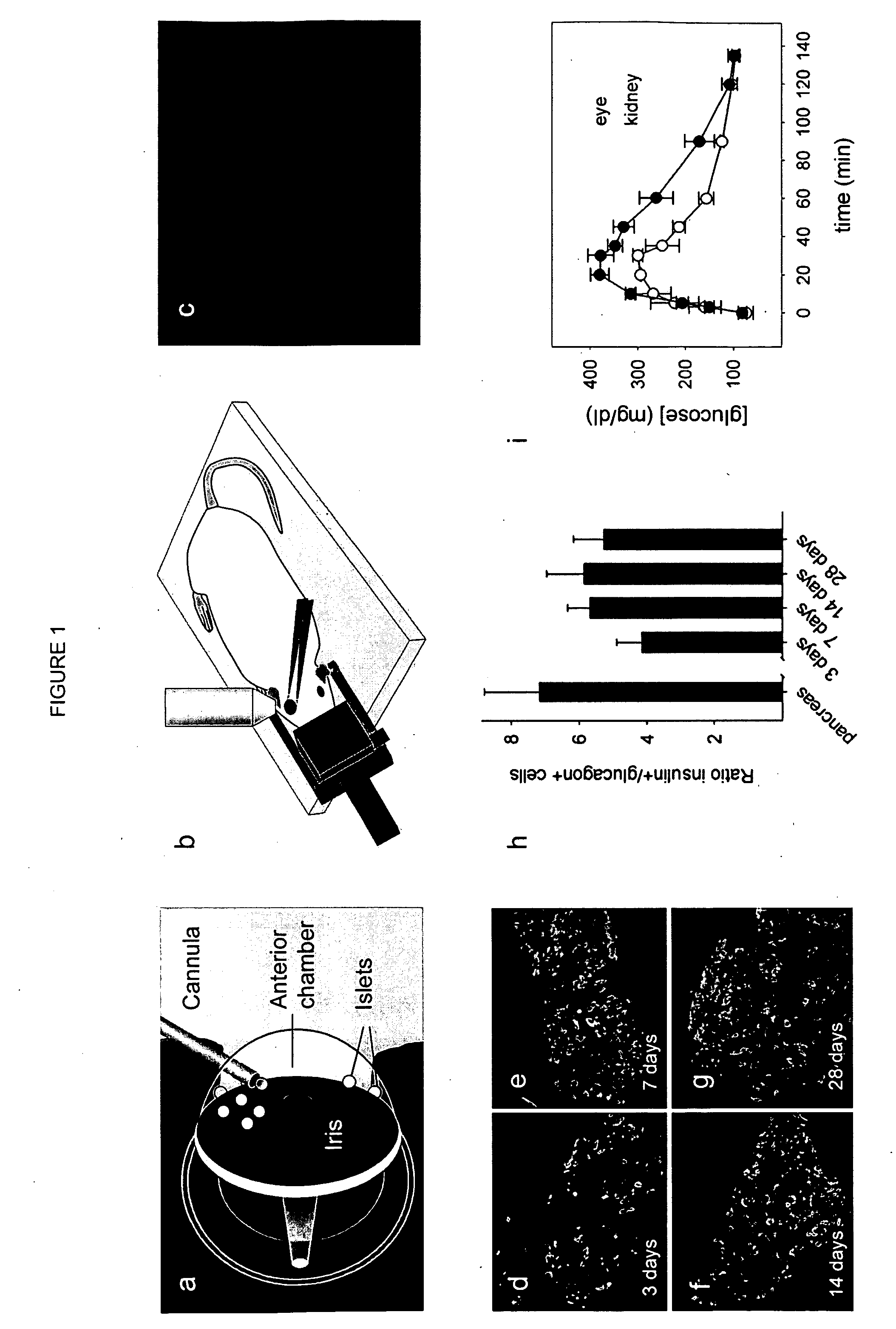 Non-Invasive In Vivo Imaging and Methods for Treating Type I Diabetes