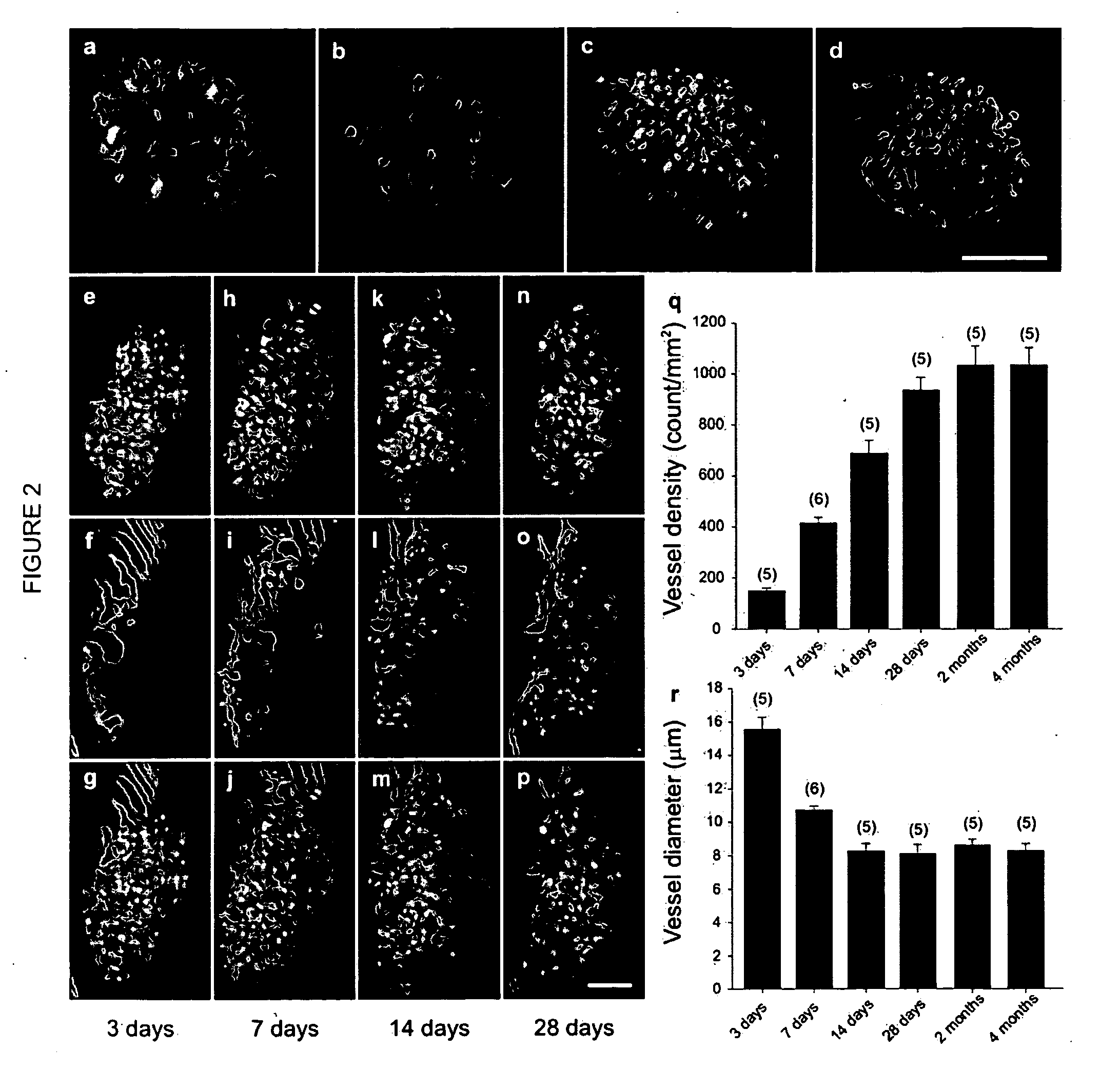 Non-Invasive In Vivo Imaging and Methods for Treating Type I Diabetes