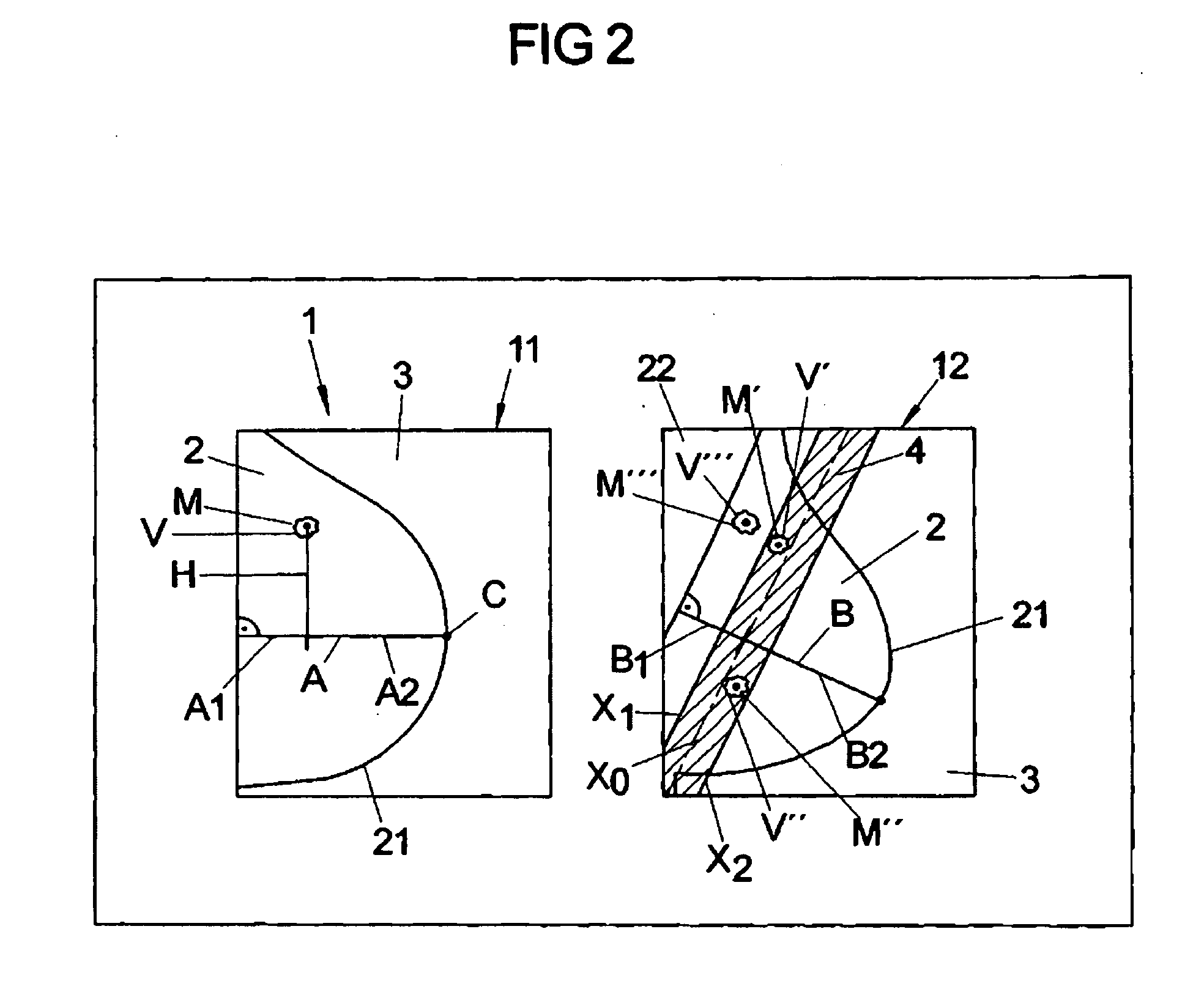 Method and Apparatus for Improved Display of Digital Mammographic Images