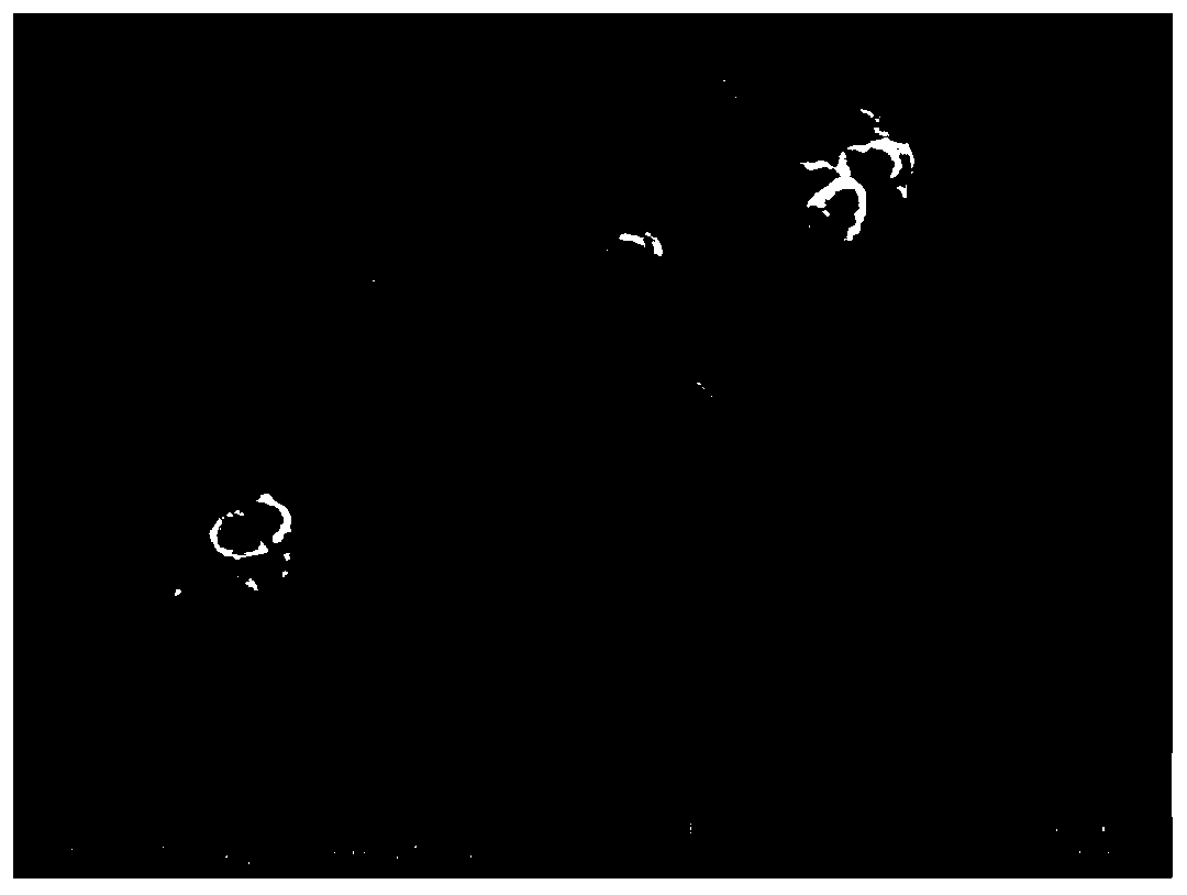 Sic@SiO&lt;2&gt; core-shell-structured nanofiller/epoxy resin-based composite material and preparation method thereof