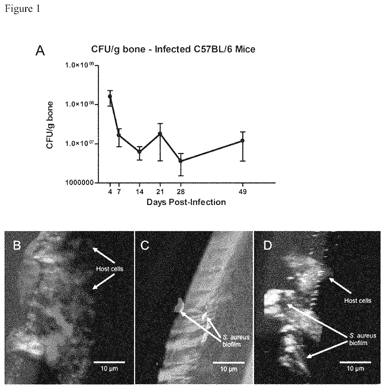 Multivalent vaccine protection from <i>Staphylococcus aureus </i>infection