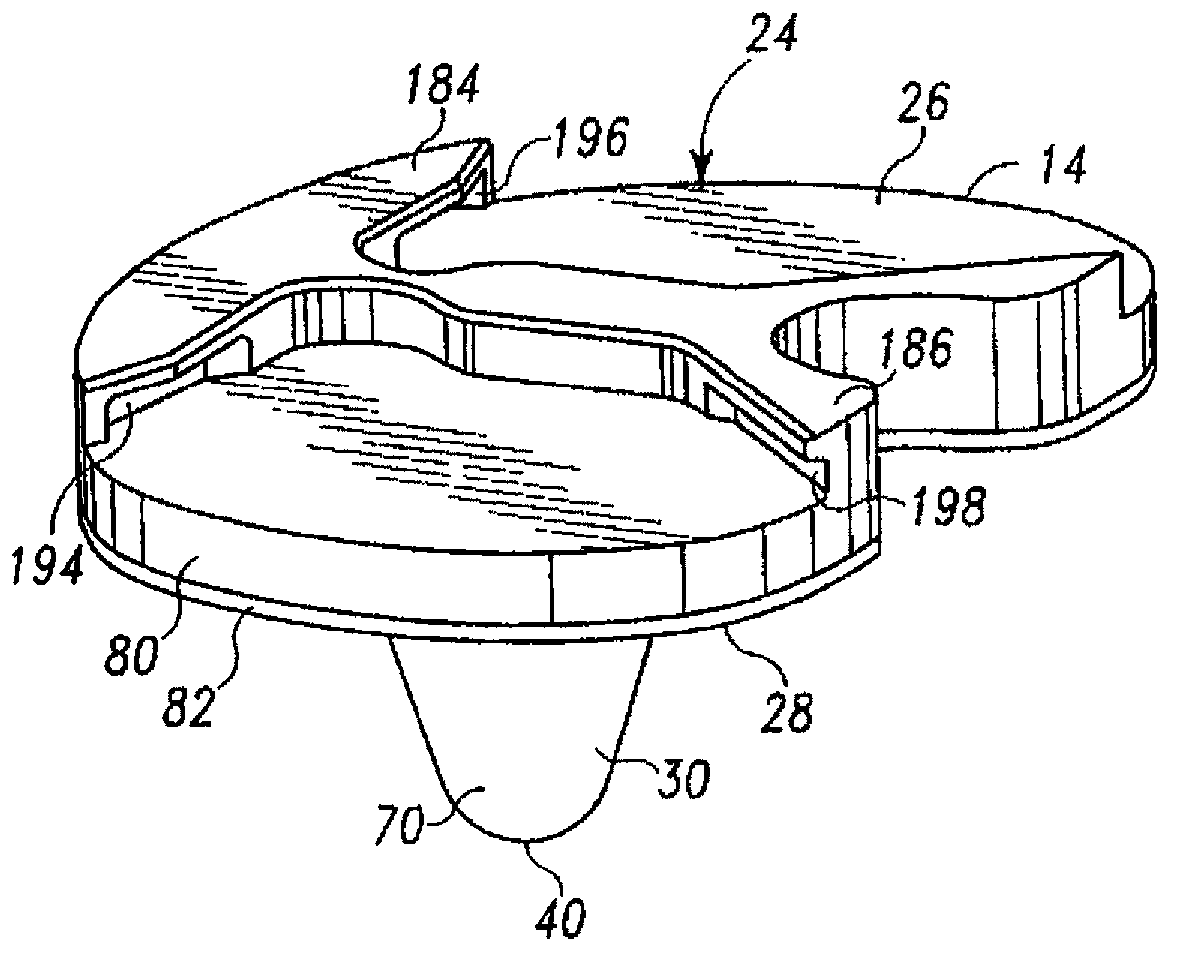 Prosthesis with surfaces having different textures and method of making the prosthesis