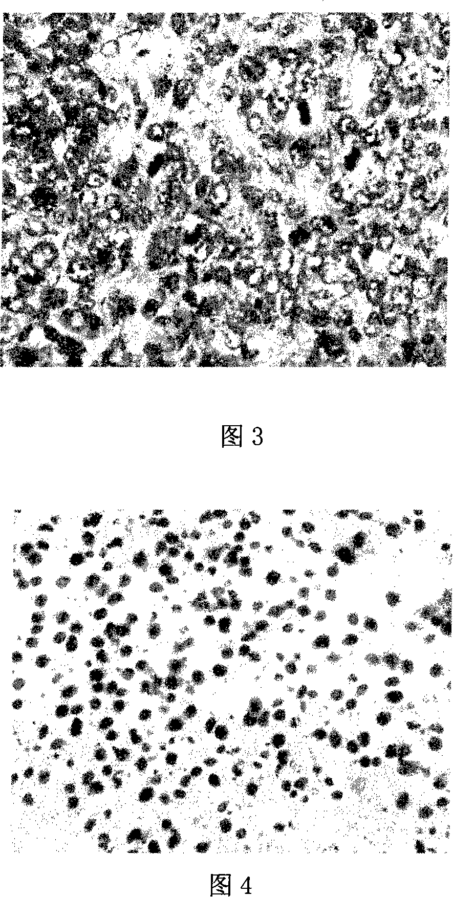 Terminal amido group start-type poly (lactic-co-glycolic acid)/polyglycol block copolymer, preparation method, medicament-carried nano micelle and application