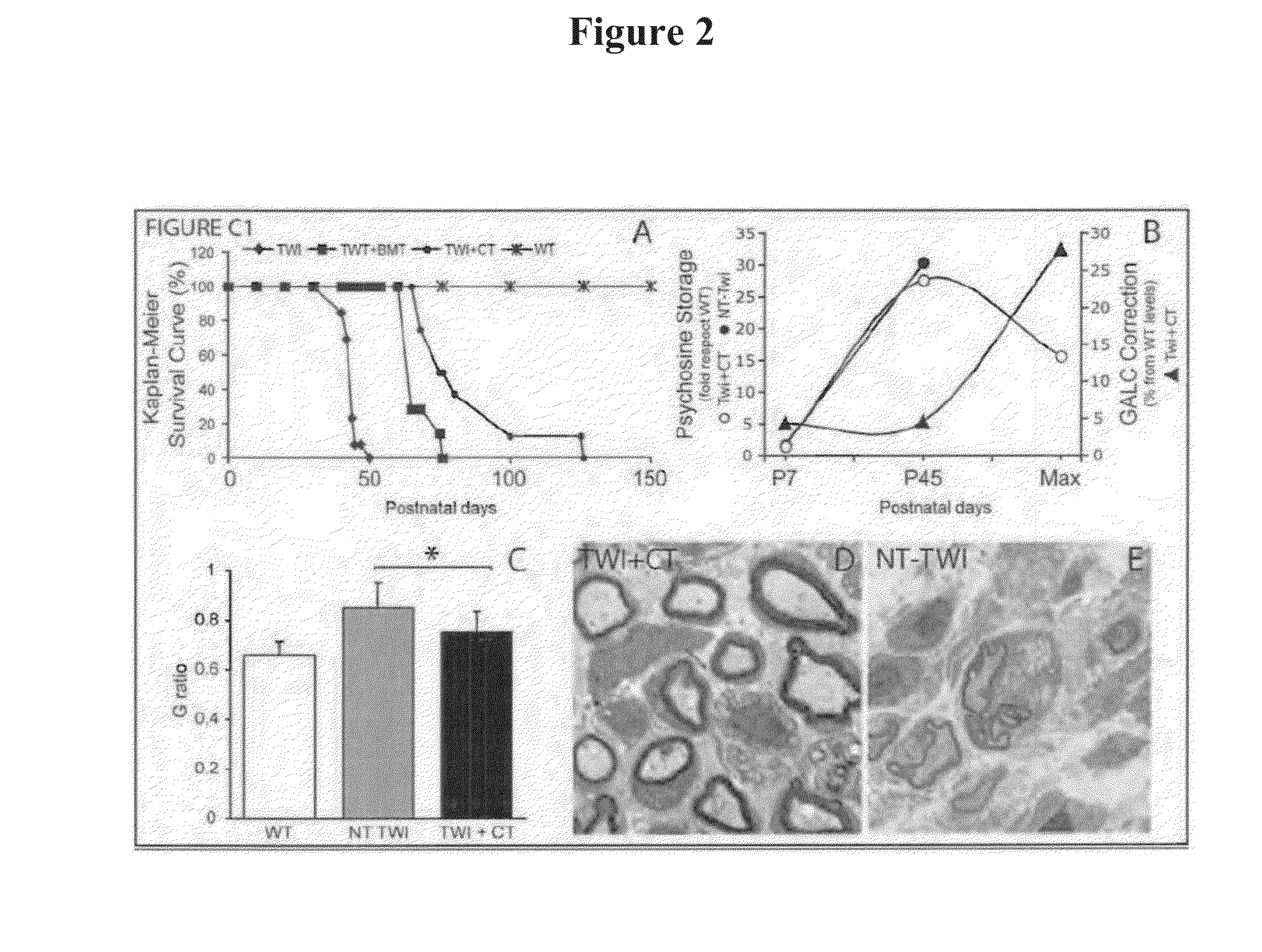 Compositions and methods for the treatment of krabbe and other neurodegenerative diseases