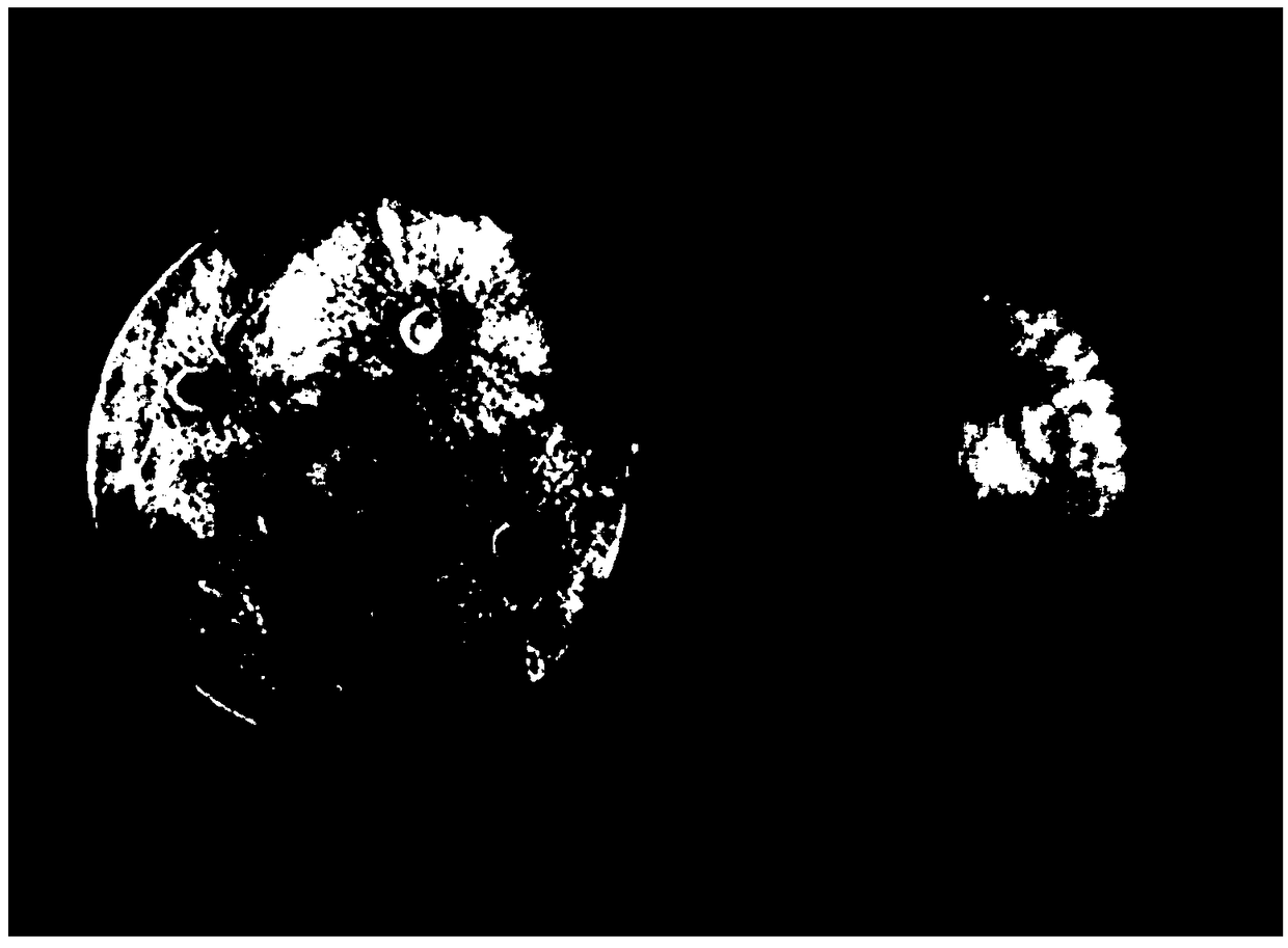 Application of sarcandra glabra endophyte RJ-1 in inhibiting phytopathogens