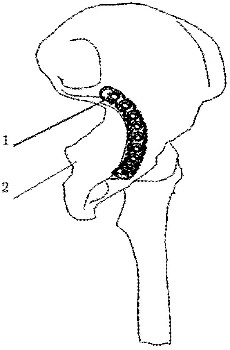 Pelvis arcuate line superior border anatomical bone plate