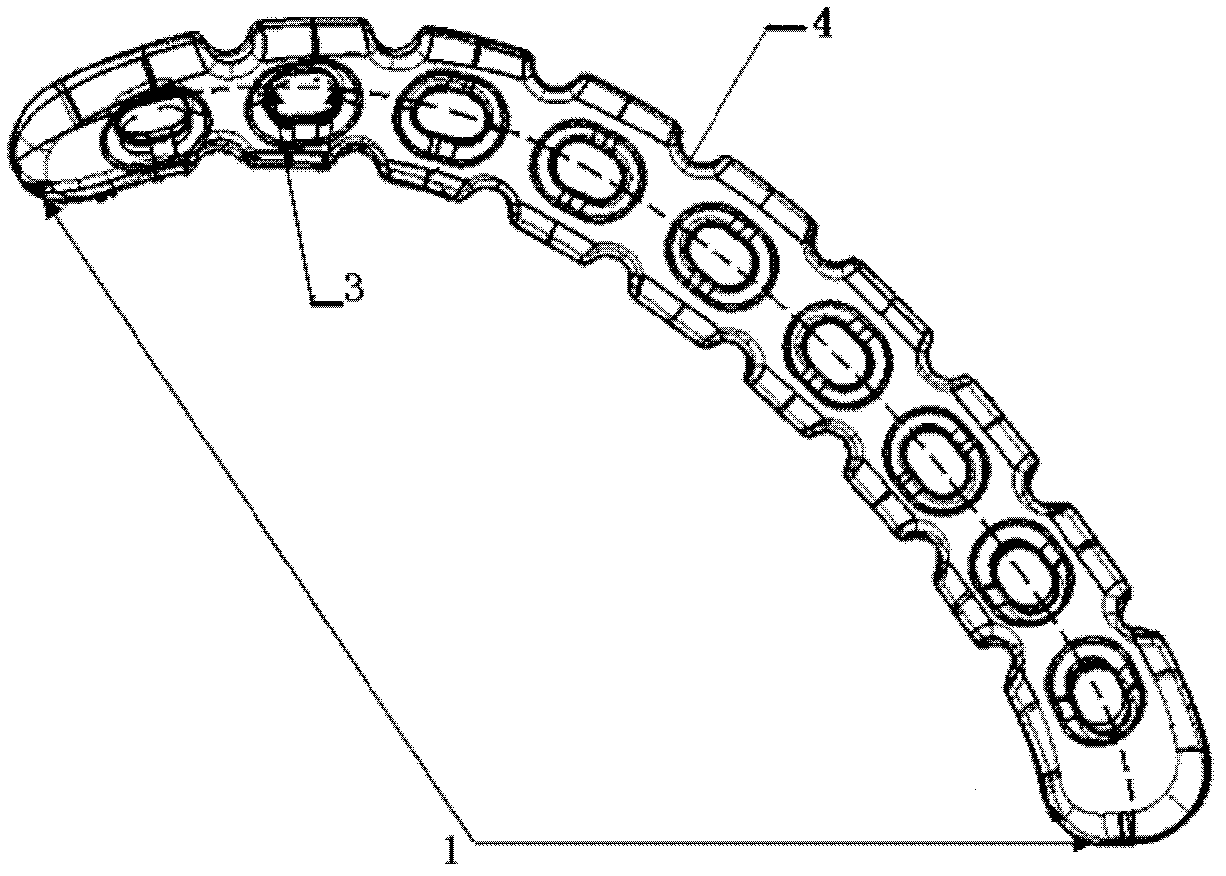 Pelvis arcuate line superior border anatomical bone plate