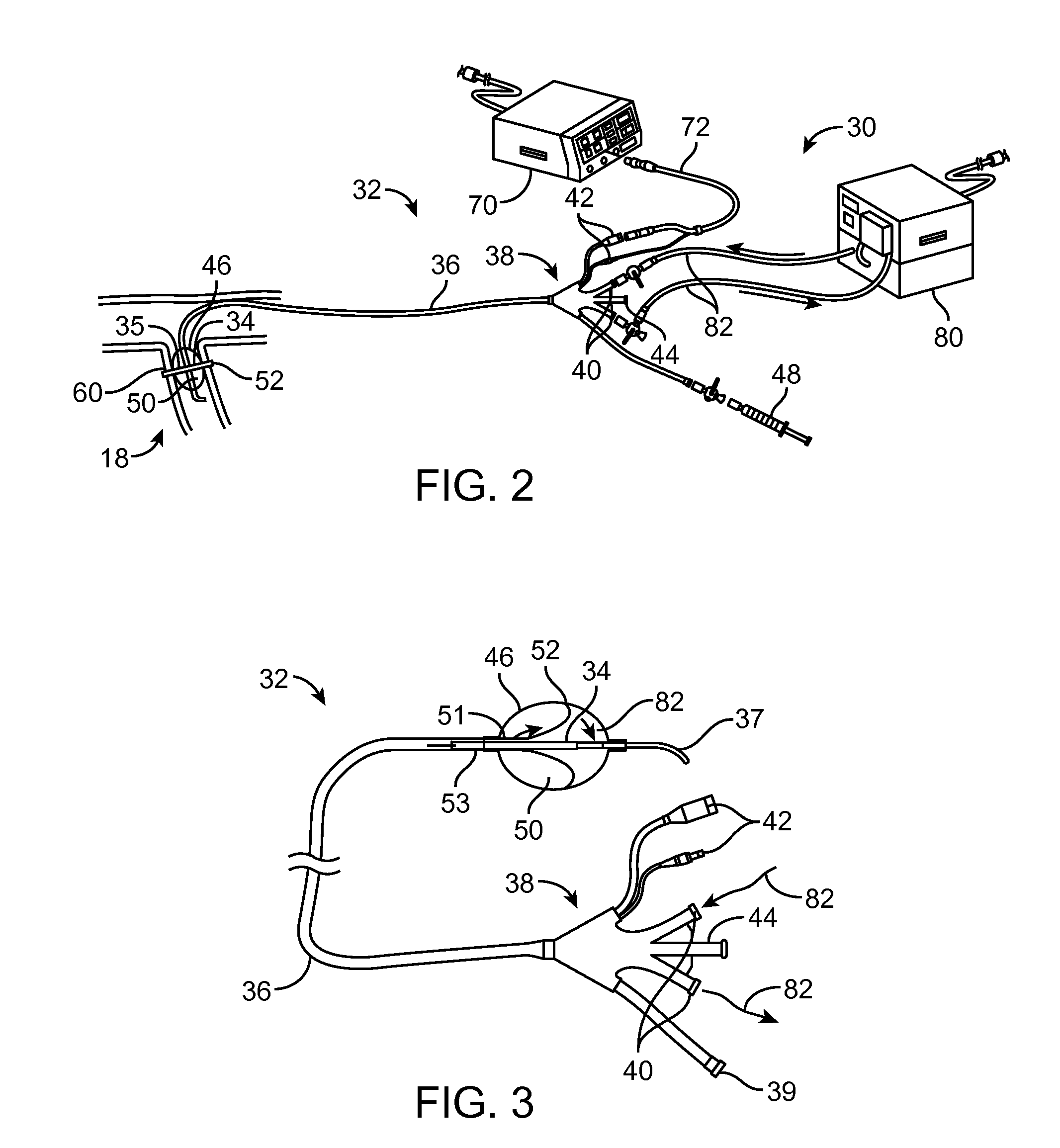 Method and apparatus employing ultrasound energy to remodulate vascular nerves