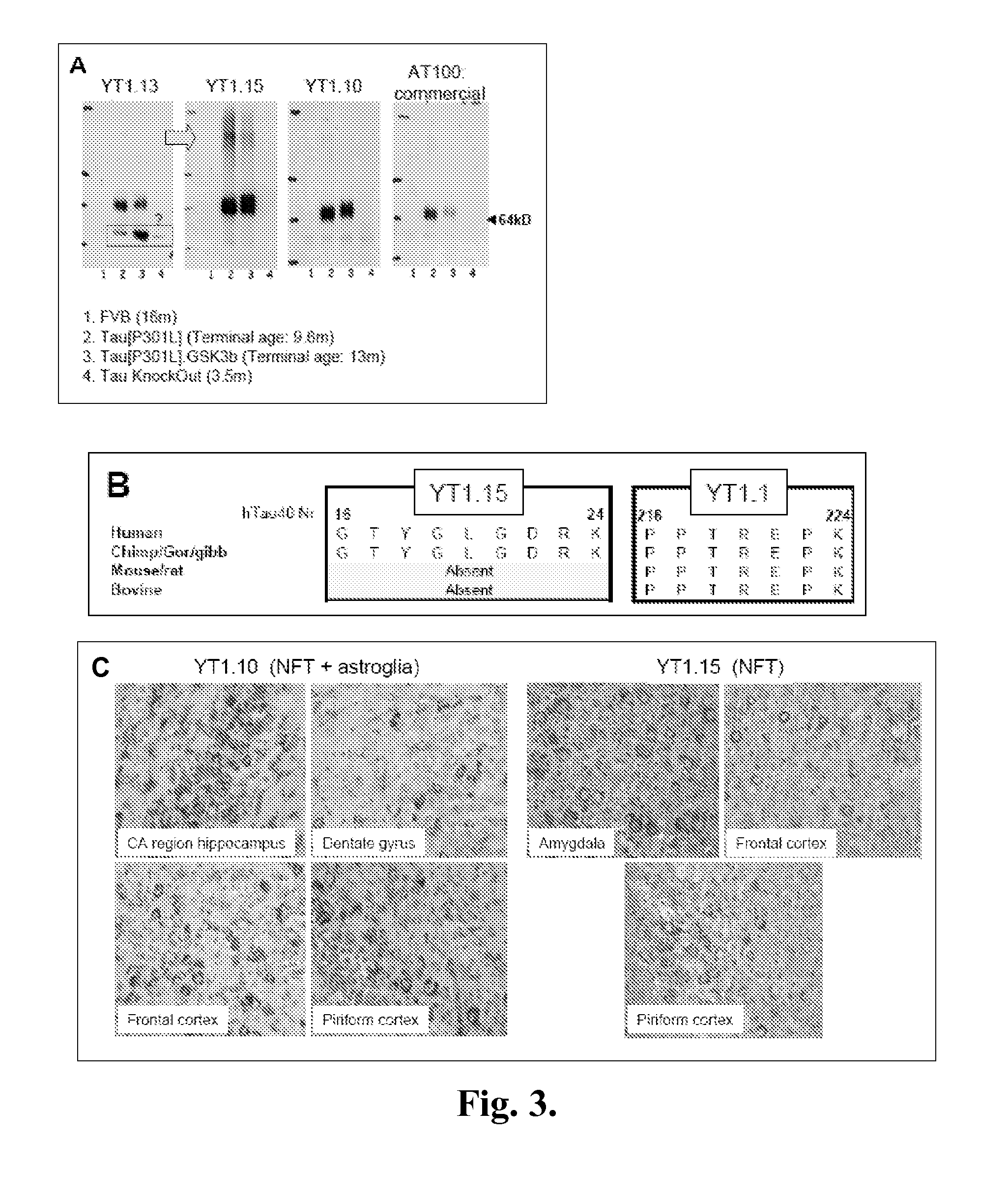 Antibodies to phosphorylated tau aggregates