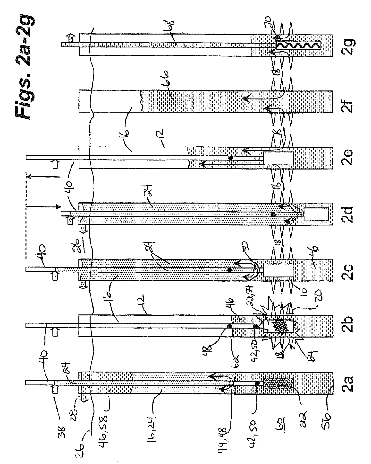 Pressure-actuated perforation with automatic fluid circulation for immediate production and removal of debris