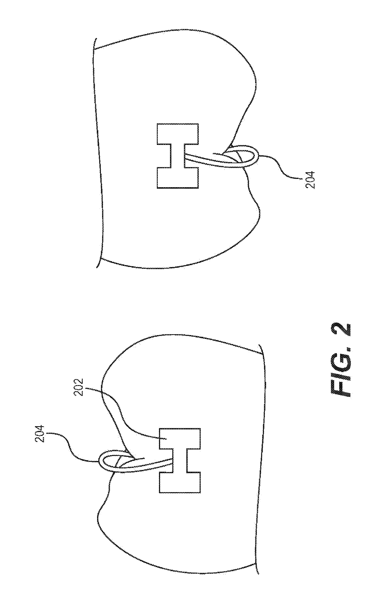 Manufacture of patient-specific orthodontic brackets with improved base and retentive features