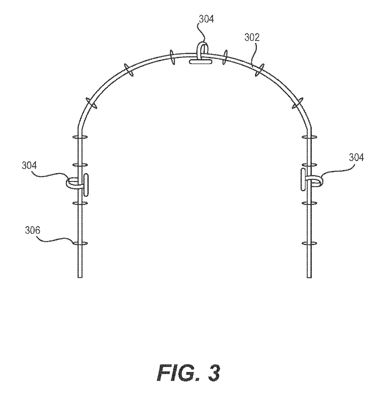 Manufacture of patient-specific orthodontic brackets with improved base and retentive features