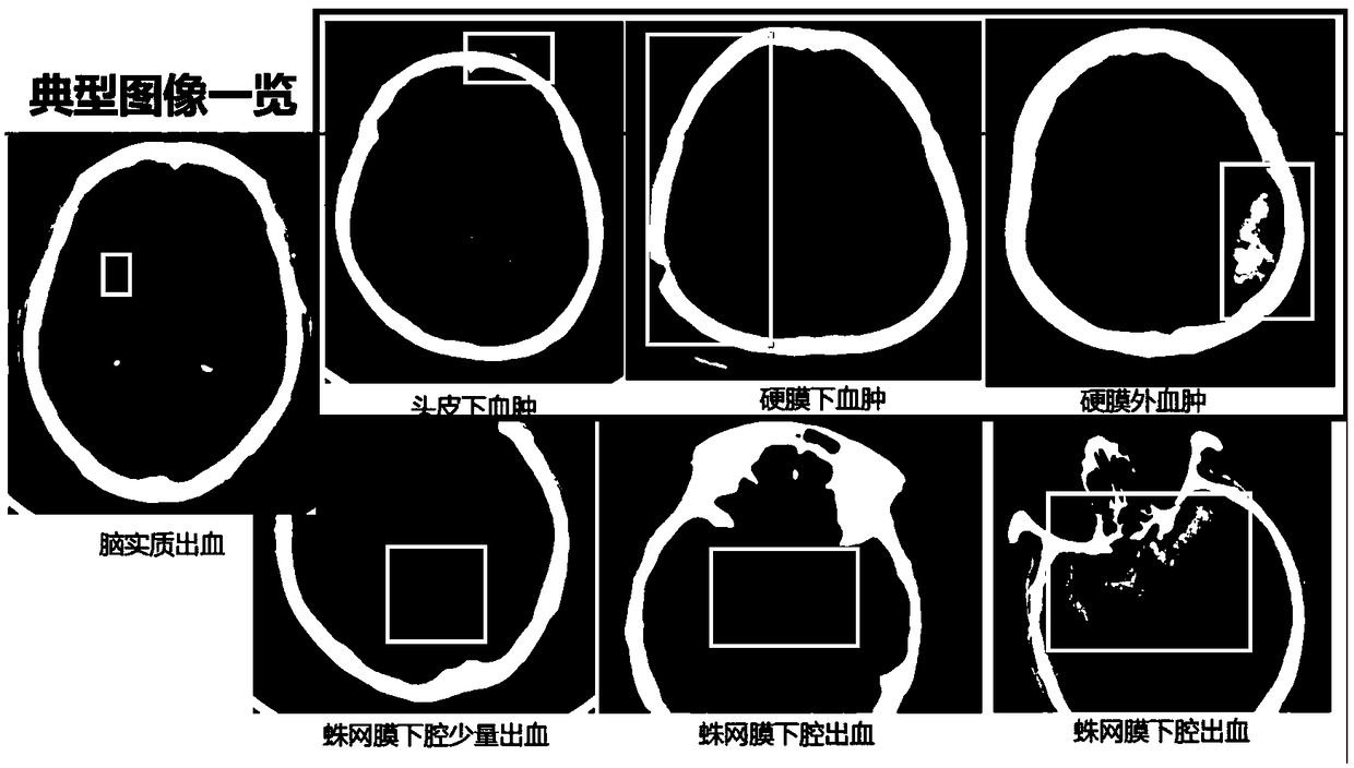 Cerebral hemorrhage image processing method, device, computer device and storage medium