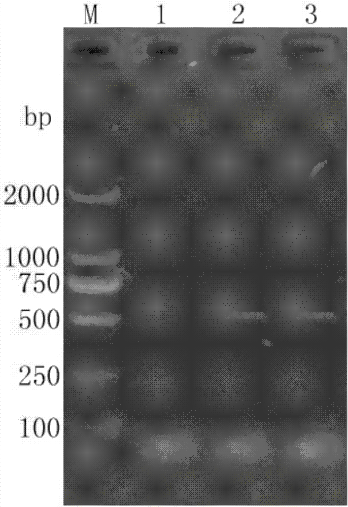 CyHV-2 (cyprinid herpesvirus 2) specificity PCR (polymerase chain reaction) detection kit and detection method