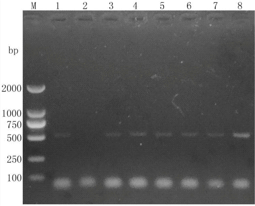 CyHV-2 (cyprinid herpesvirus 2) specificity PCR (polymerase chain reaction) detection kit and detection method