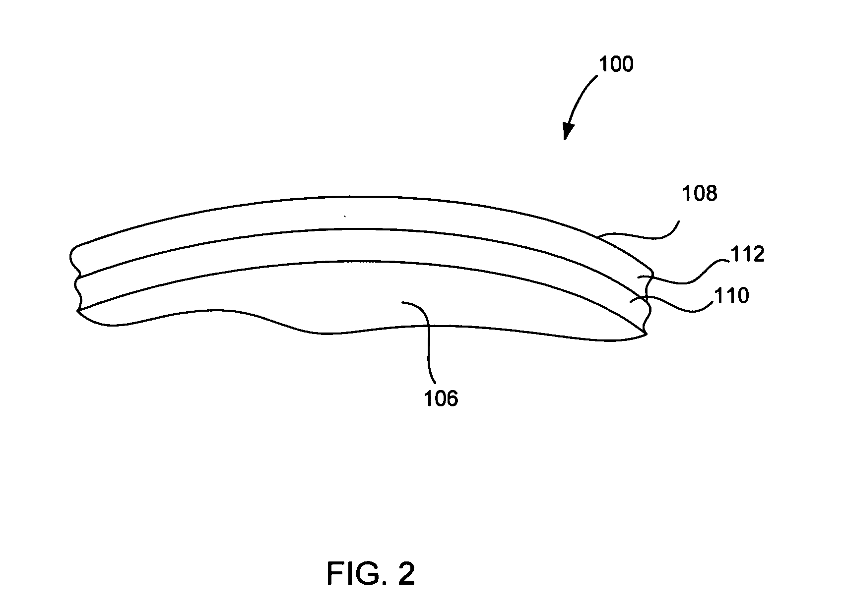 Laser based metal deposition of implant structures