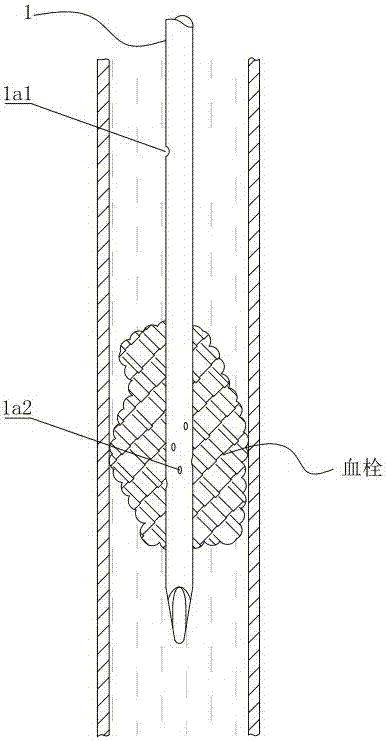 Thrombolysis tube