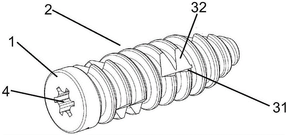 Reinforcing interface nail